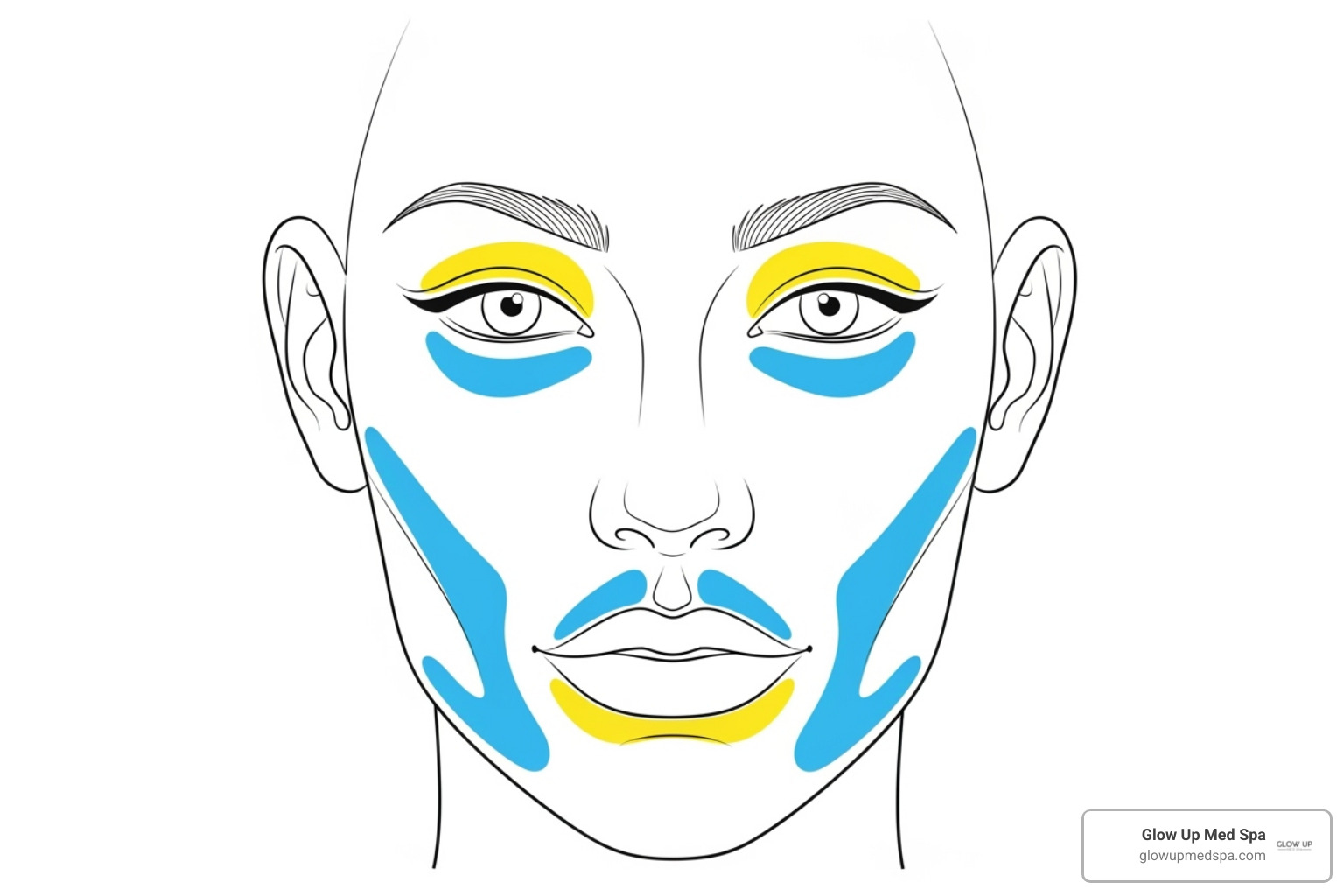 face map highlighting popular dermal filler injection sites like cheeks, lips, and under-eyes - dermal fillers orange county
