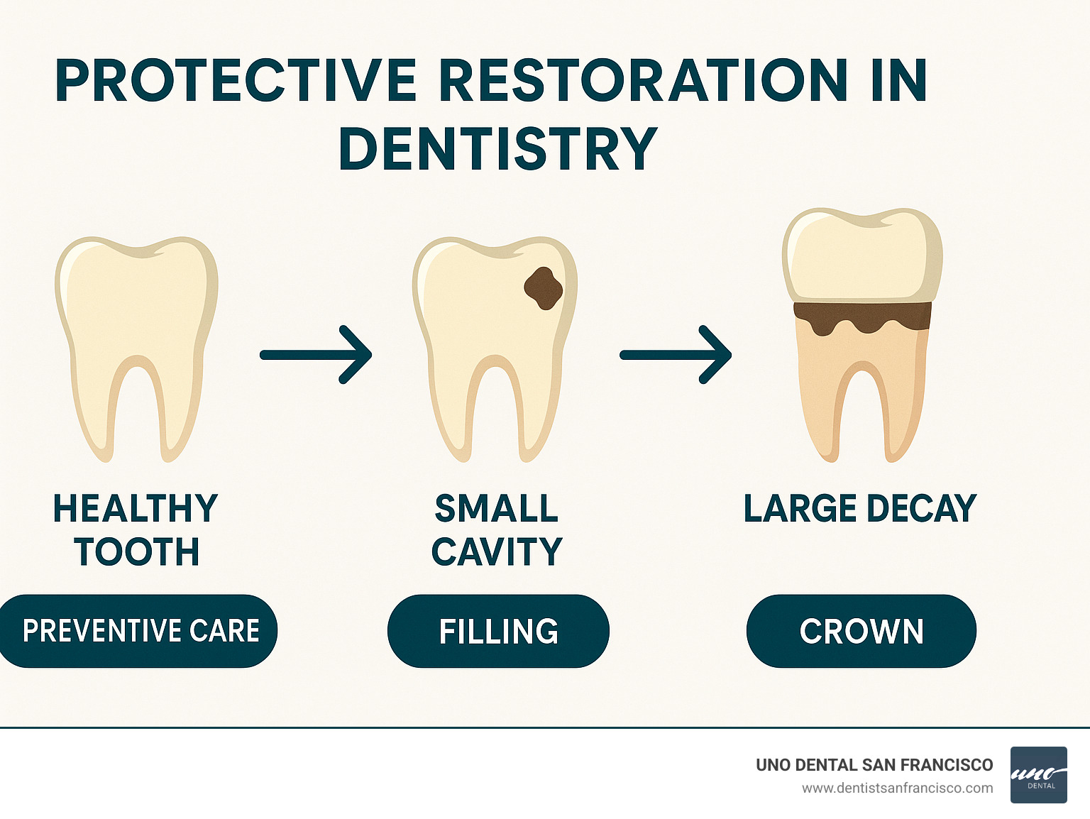 Infographic showing the progression from healthy tooth to small cavity to large decay requiring crown, with treatment options at each stage including preventive care, fillings, and crowns - what is a protective restoration in dentistry infographic 