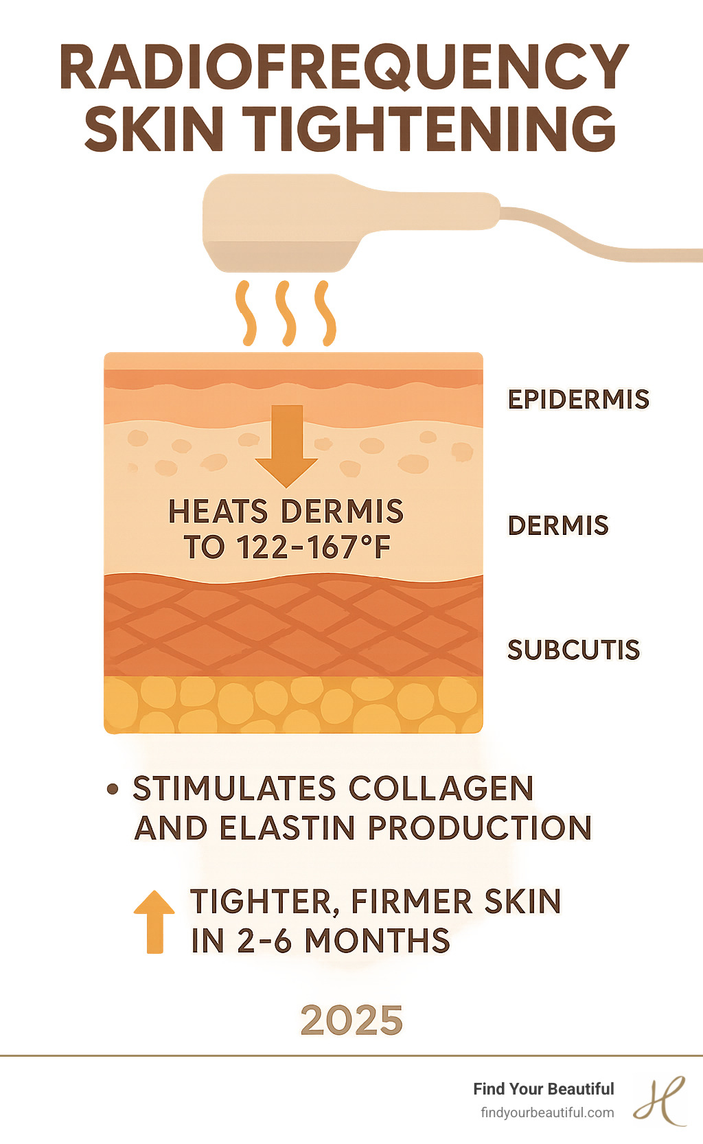Infographic showing radiofrequency waves penetrating skin layers, heating the dermis to 122-167°F, stimulating collagen and elastin production, resulting in tighter, firmer skin over 2-6 months - does radiofrequency tighten skin infographic 