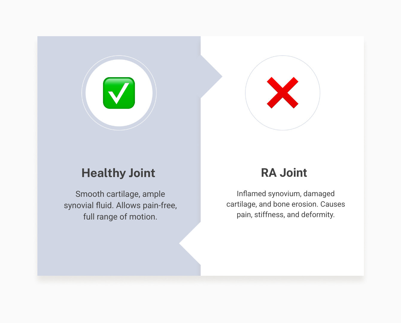 Infographic showing the difference between a healthy joint with smooth cartilage and synovial fluid versus a rheumatoid arthritis joint with inflamed synovium, damaged cartilage, and bone erosion, illustrating how the autoimmune process affects joint structure - rheumatoid arthritis infographic comparison-2-items-formal Infographic showing the difference between a healthy joint with smooth cartilage and synovial fluid versus a rheumatoid arthritis joint with inflamed synovium, damaged cartilage, and bone erosion, illustrating how the autoimmune process affects joint structure - rheumatoid arthritis infographic comparison-2-items-formal