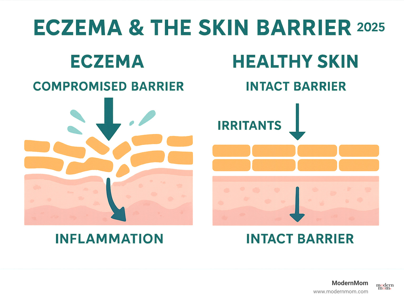Infographic showing how eczema creates a compromised skin barrier with gaps between skin cells, allowing irritants to penetrate deeper and cause inflammation, compared to healthy skin with intact barrier protection - eczema friendly makeup remover infographic 