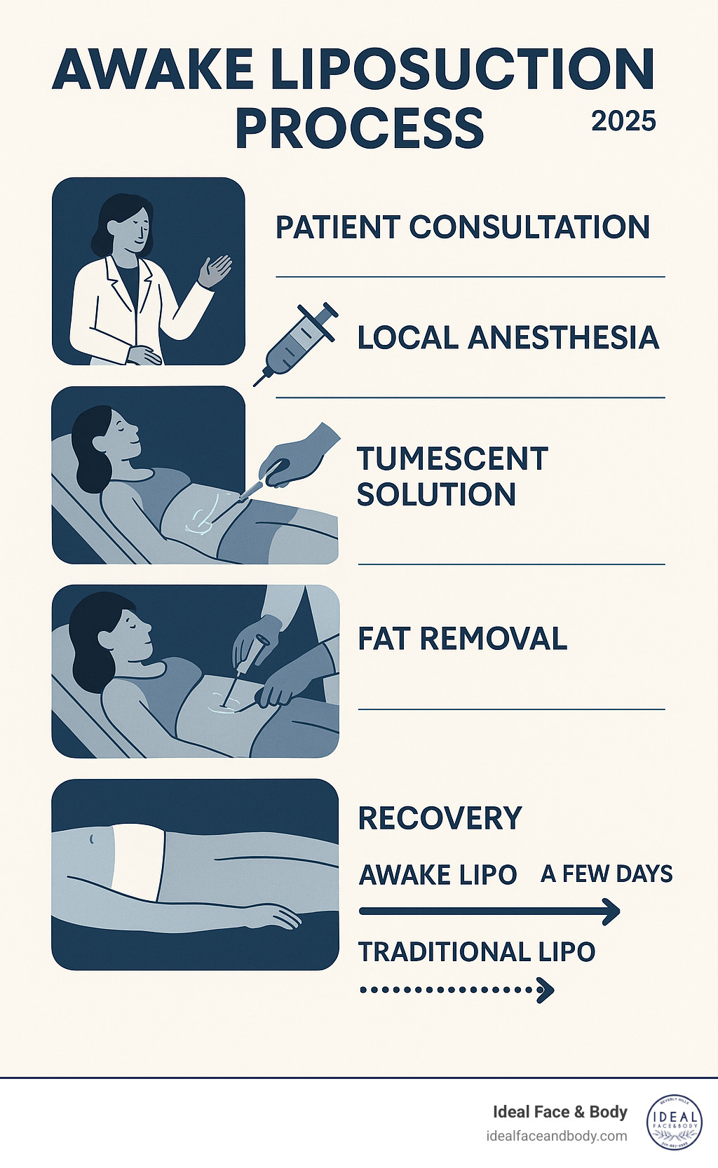 Infographic showing awake liposuction process: patient consultation, local anesthesia administration, tumescent solution injection, fat removal with cannula, and recovery timeline compared to traditional liposuction methods - awake lipo infographic 