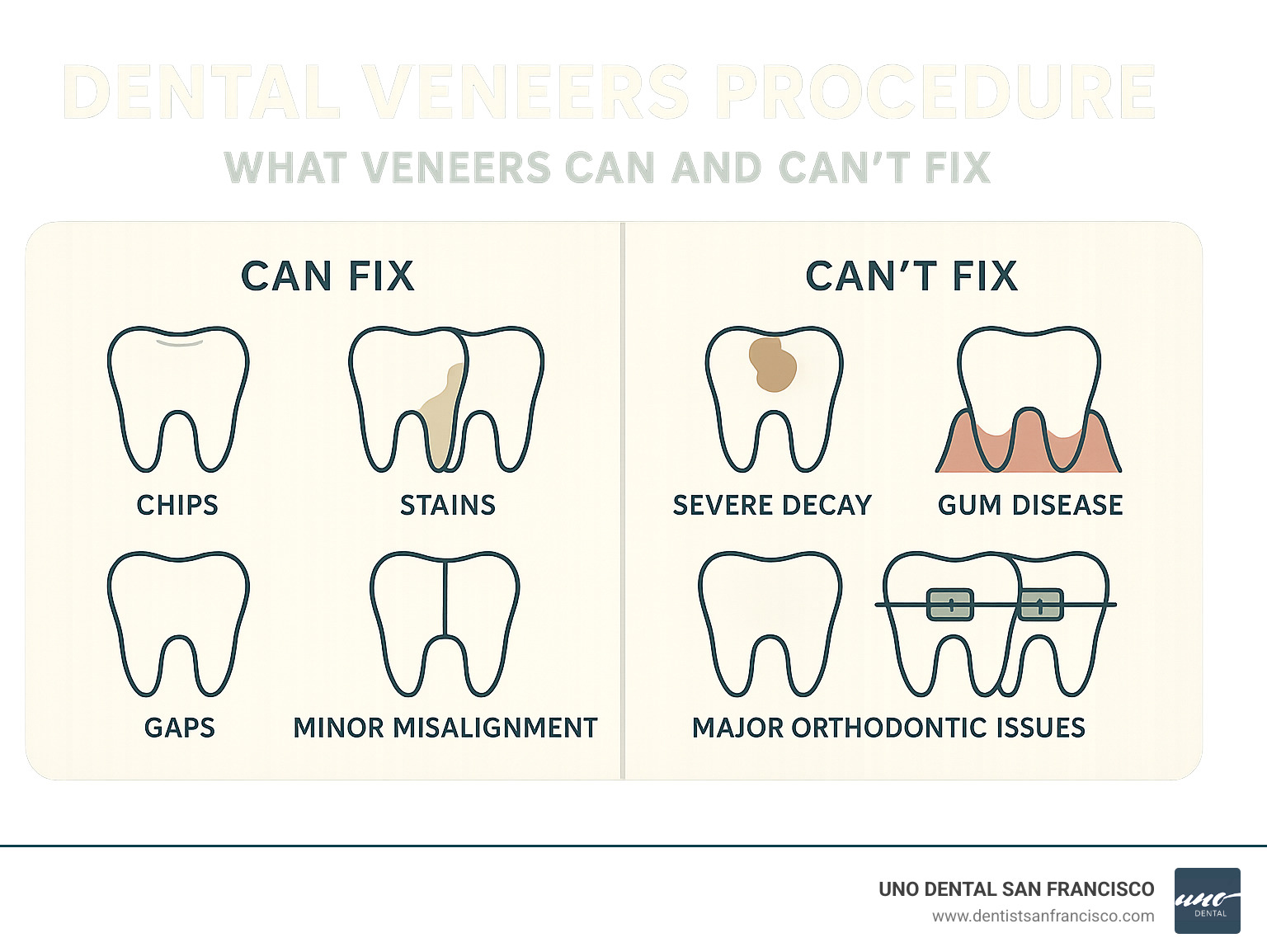 Infographic showing dental conditions that veneers can fix including chips, stains, gaps, and minor misalignment versus conditions they cannot treat such as severe decay, gum disease, and major orthodontic issues - dental veneers procedure infographic 