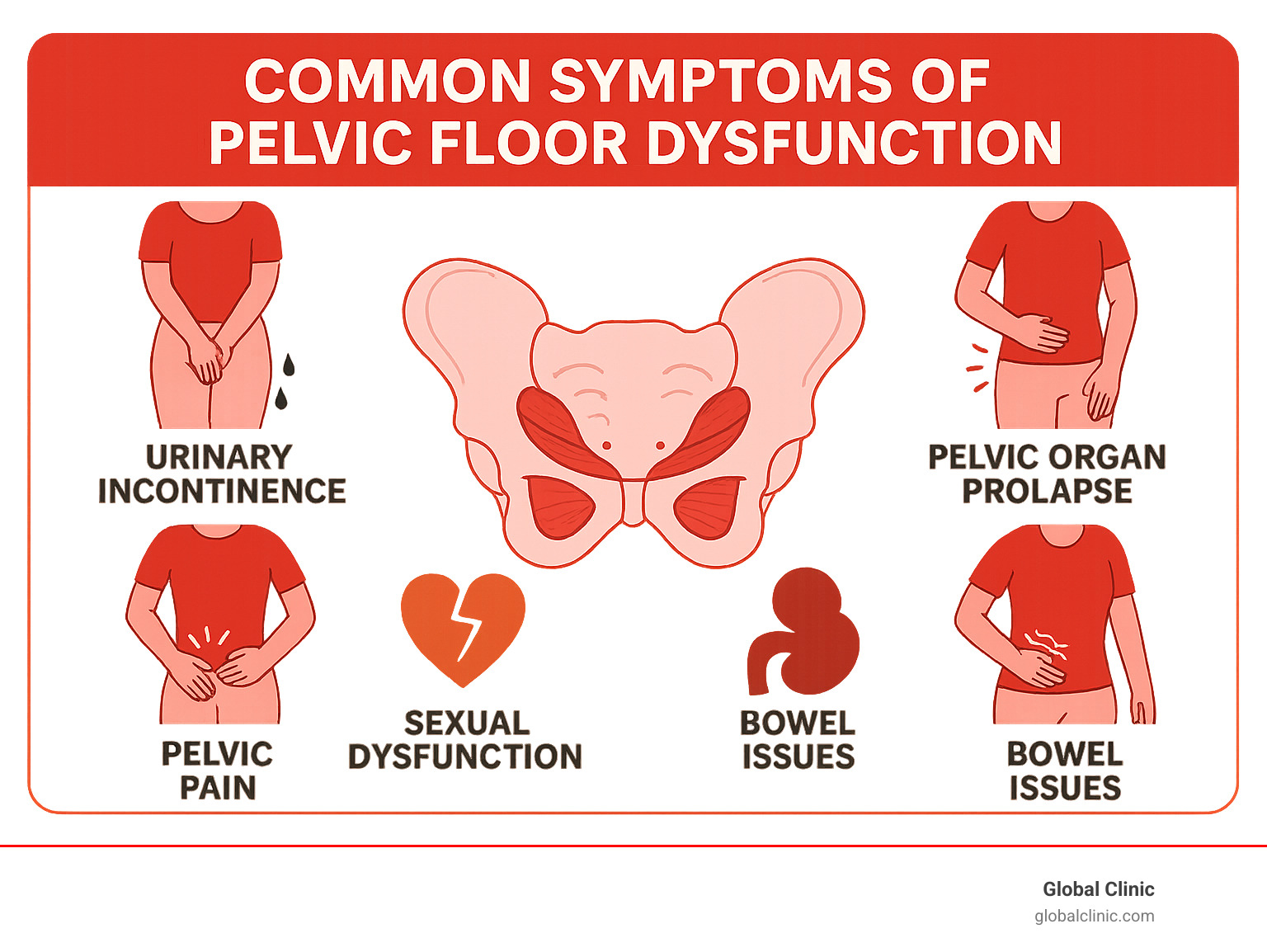 infographic explaining the common symptoms of pelvic floor dysfunction - pelvic floor pt infographic 