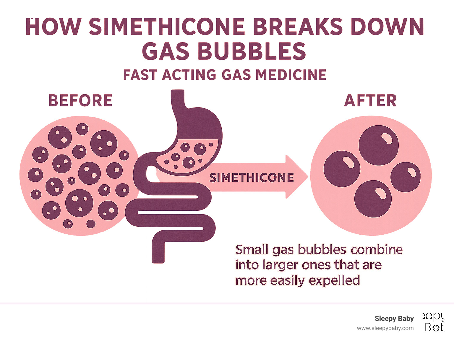 Infographic showing how simethicone breaks down gas bubbles in the digestive tract, with before and after illustrations of small bubbles combining into larger bubbles that can be easily expelled from the stomach and intestines - fast acting gas medicine infographic 