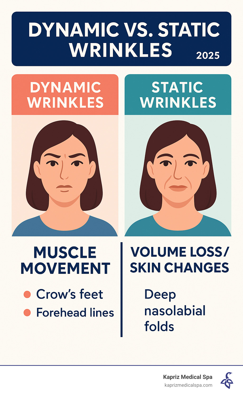 Infographic comparing dynamic wrinkles caused by muscle movement (like crow's feet and forehead lines) versus static wrinkles caused by volume loss and skin changes (like deep nasolabial folds) - smile lines botox infographic 