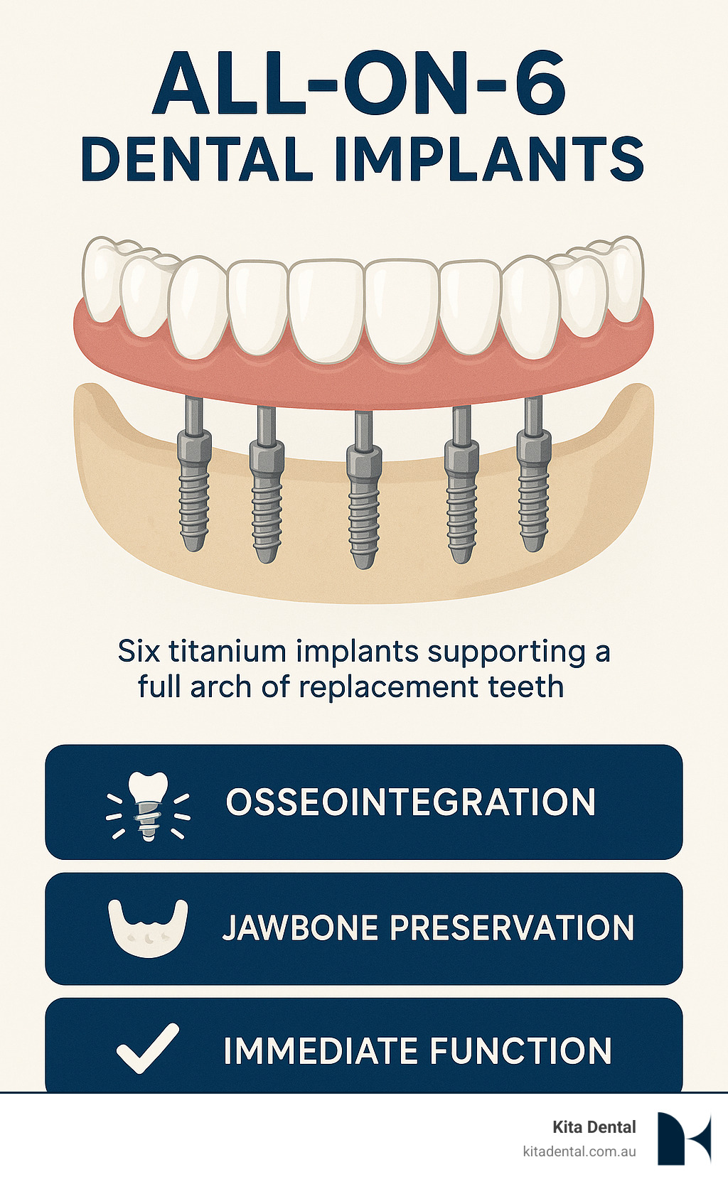 Infographic showing six titanium implants placed strategically in the jawbone supporting a full arch of replacement teeth, with labels indicating osseointegration process, jawbone preservation, and immediate function capabilities - all-on-6 dental implants infographic Infographic showing six titanium implants placed strategically in the jawbone supporting a full arch of replacement teeth, with labels indicating osseointegration process, jawbone preservation, and immediate function capabilities - all-on-6 dental implants infographic