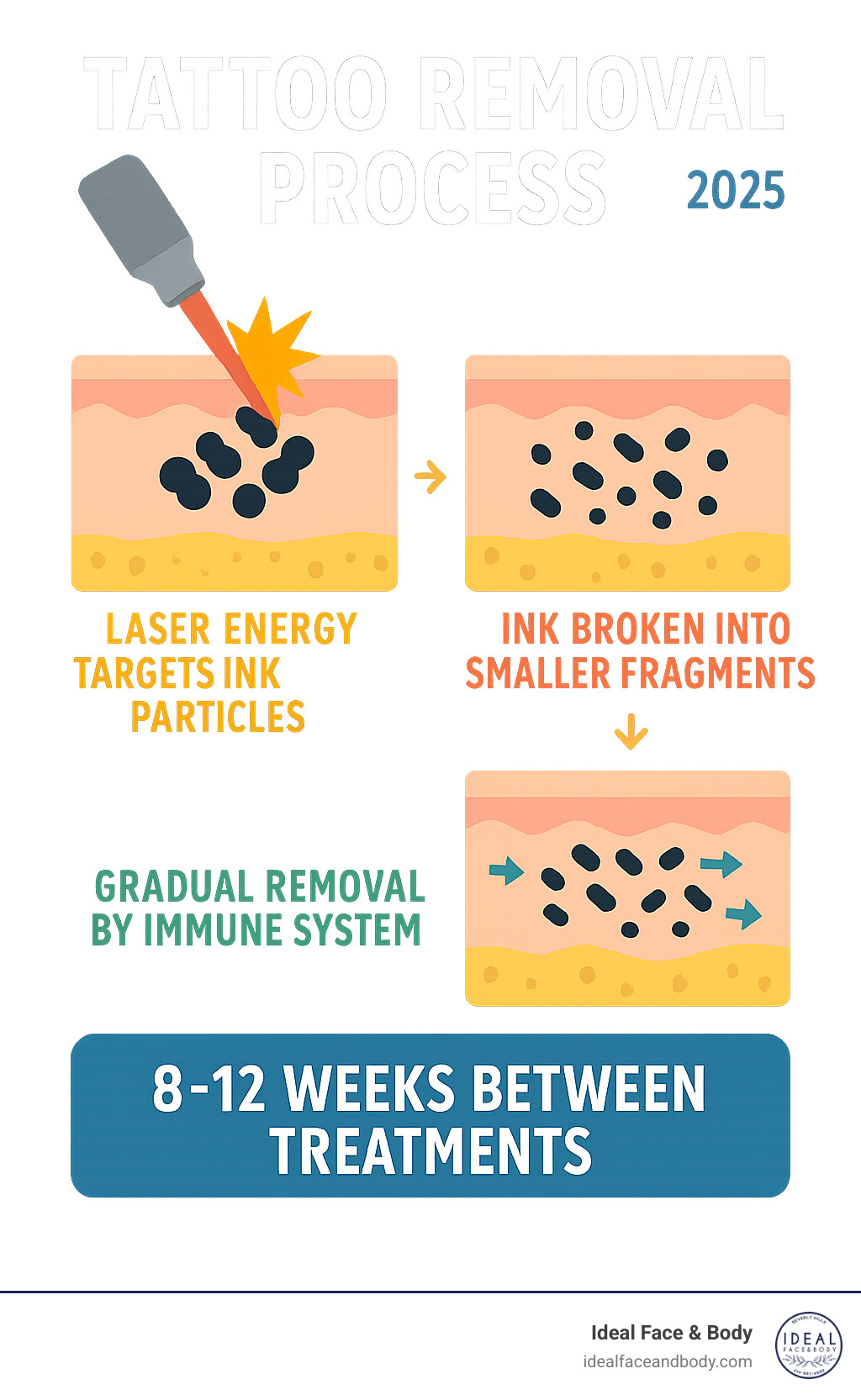 Infographic showing laser tattoo removal process: laser energy targets ink particles in the dermis, breaking them into smaller fragments that are gradually eliminated by the body's immune system through lymphatic drainage over 8-12 week intervals between treatments - tattoo removal before and after pictures infographic 