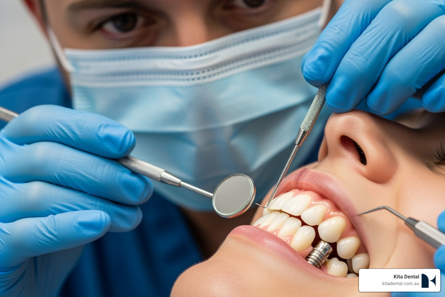 Dentist examining a patient's full arch implants - caring for full arch implants Dentist examining a patient's full arch implants - caring for full arch implants