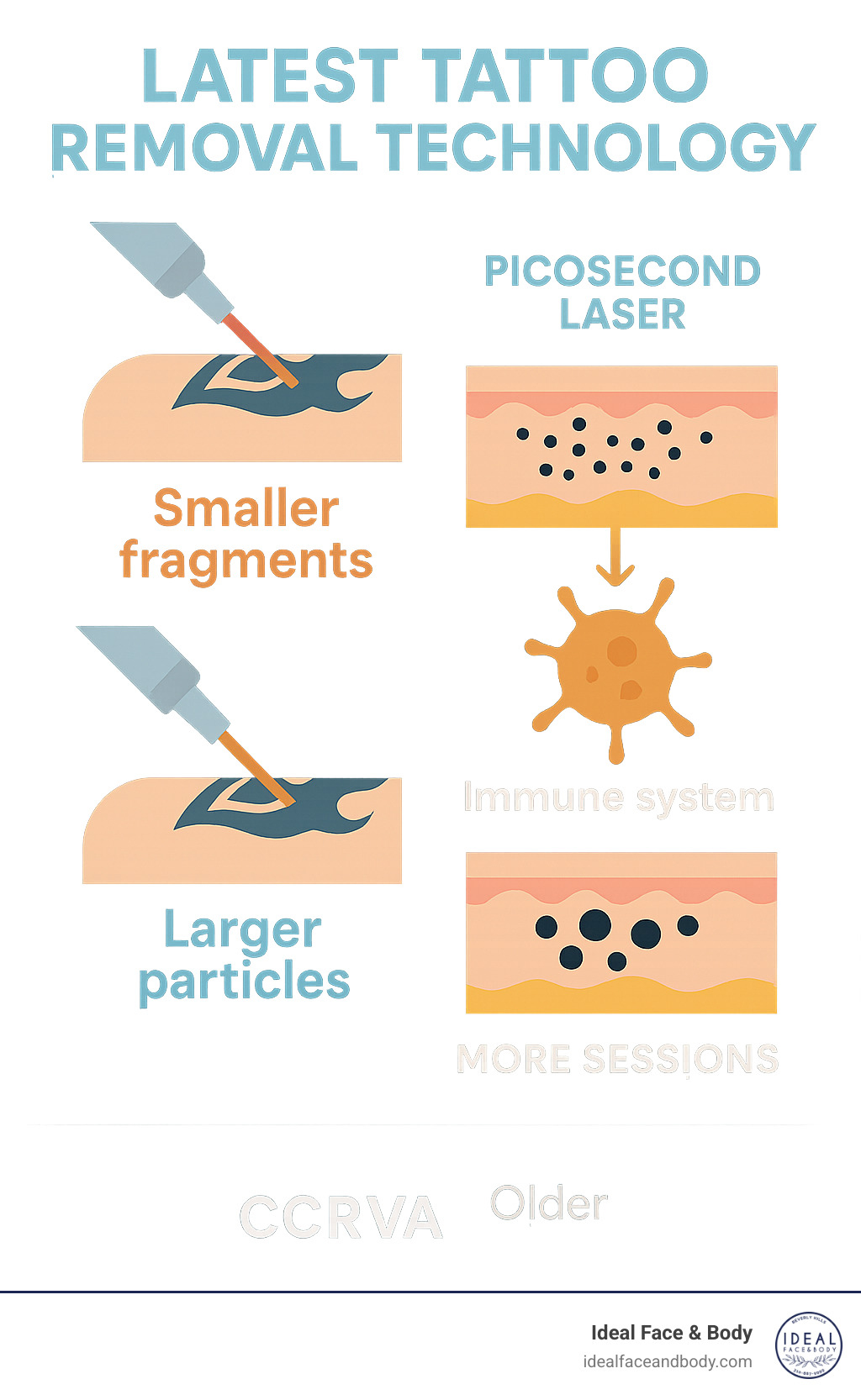 Infographic showing how modern picosecond lasers break down tattoo ink particles into smaller fragments that the body's immune system can naturally eliminate, compared to older nanosecond technology that creates larger particles requiring more sessions - Latest tattoo removal technology infographic 
