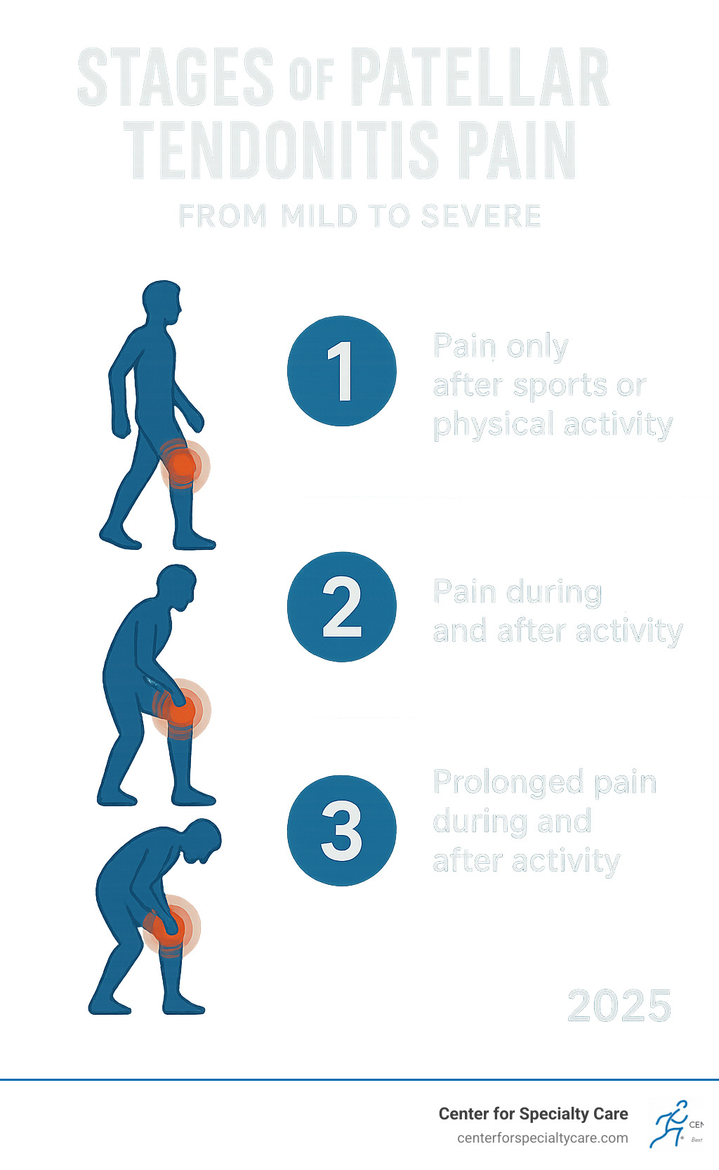 Infographic explaining the stages of patellar tendonitis pain from mild to severe - is heat good for patellar tendonitis infographic 