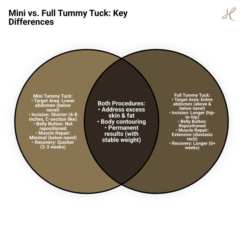 Infographic showing the difference between mini tummy tuck and full tummy tuck treatment areas, highlighting that mini tummy tuck focuses only on the lower abdomen below the navel with a shorter incision, while full tummy tuck addresses the entire abdominal area with belly button repositioning - mini tummy tuck infographic venn_diagram Infographic showing the difference between mini tummy tuck and full tummy tuck treatment areas, highlighting that mini tummy tuck focuses only on the lower abdomen below the navel with a shorter incision, while full tummy tuck addresses the entire abdominal area with belly button repositioning - mini tummy tuck infographic venn_diagram