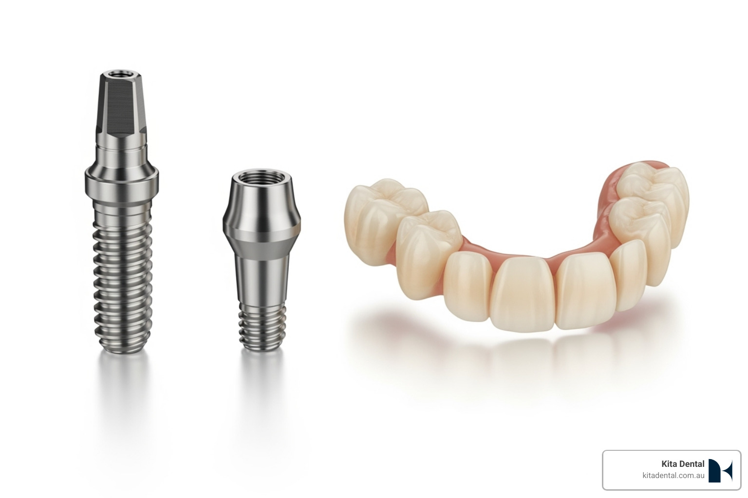 components of a full-arch implant system - Implant treatment, full- arch treatment components of a full-arch implant system - Implant treatment, full- arch treatment