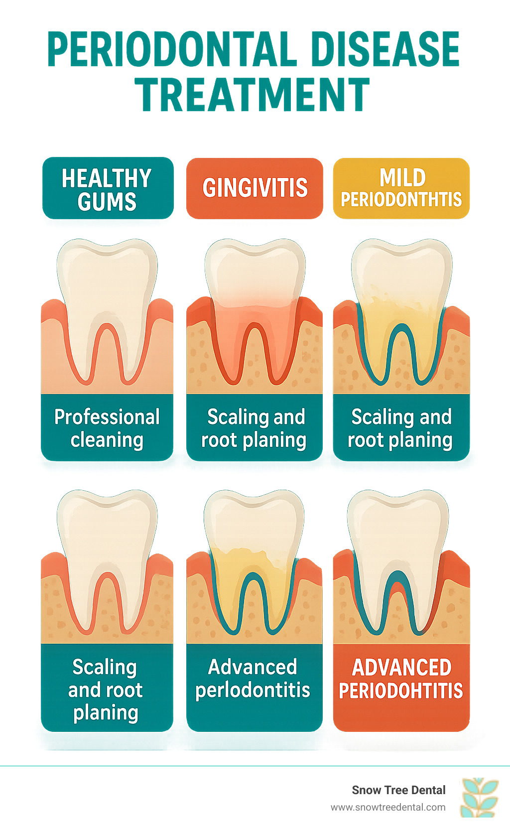Comprehensive infographic showing the progression of gum disease from healthy gums through gingivitis to mild, moderate, and advanced periodontitis, with corresponding treatment options for each stage including professional cleaning, scaling and root planing, and surgical interventions - periodontal disease treatment infographic 