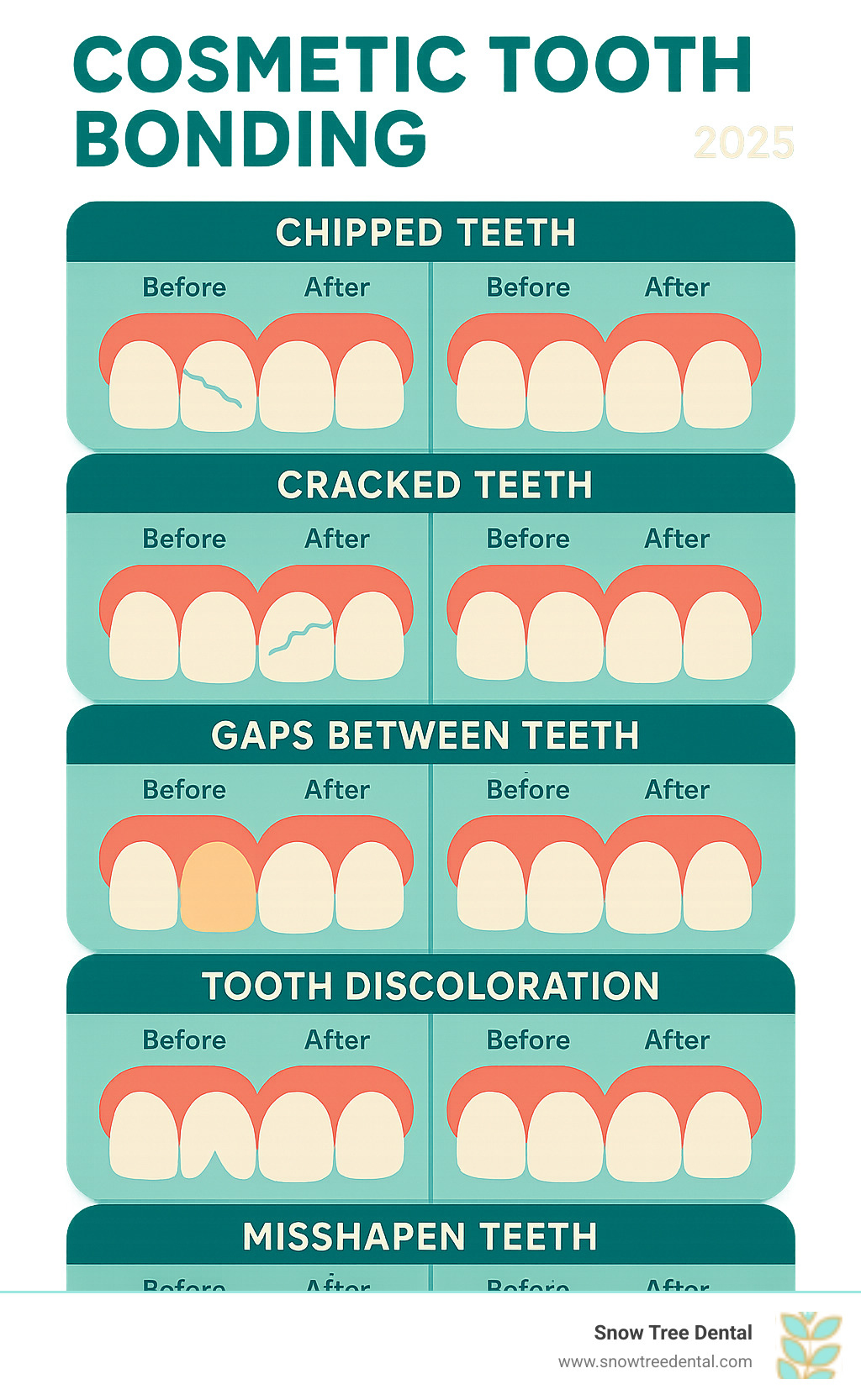 Infographic showing the 5 most common dental issues fixed by cosmetic tooth bonding: chipped teeth, cracked teeth, gaps between teeth, tooth discoloration, and misshapen teeth, with before and after illustrations for each - cosmetic tooth bonding infographic 