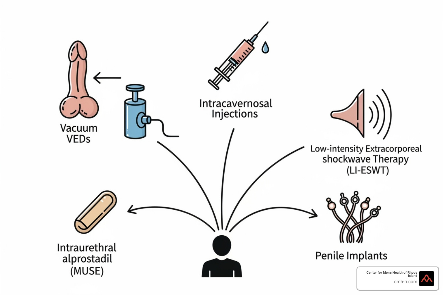 Diagram illustrating alternative ED treatments - what is the most effective treatment for erectile dysfunction Diagram illustrating alternative ED treatments - what is the most effective treatment for erectile dysfunction