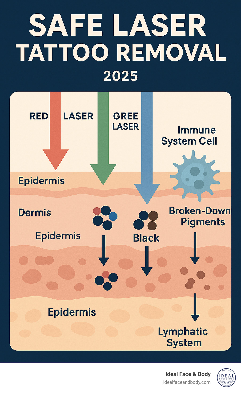Infographic showing laser light wavelengths targeting different colored ink particles in skin layers, with immune system cells removing broken-down pigments through lymphatic system - Safe laser tattoo removal infographic  Infographic showing laser light wavelengths targeting different colored ink particles in skin layers, with immune system cells removing broken-down pigments through lymphatic system - Safe laser tattoo removal infographic