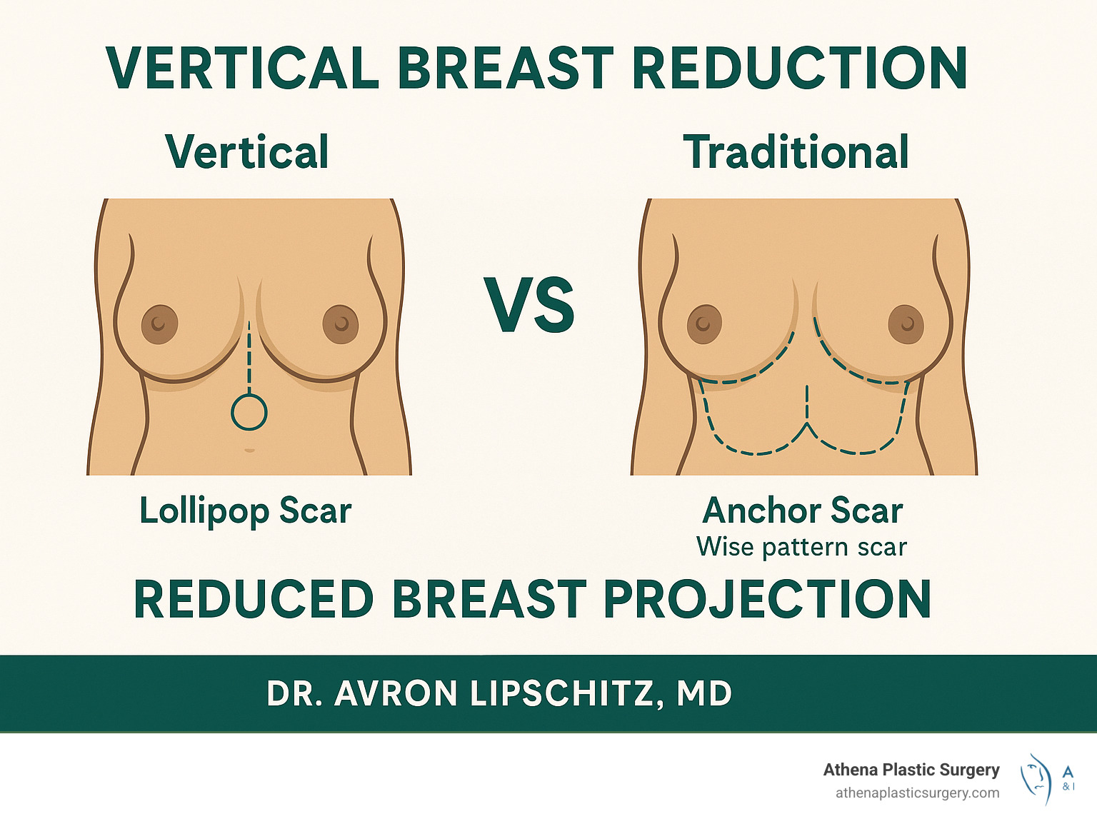 Detailed comparison infographic showing vertical breast reduction lollipop scar pattern versus traditional Wise pattern anchor scar, highlighting the reduced scarring and improved breast projection achieved with the vertical technique - Vertical breast reduction infographic Detailed comparison infographic showing vertical breast reduction lollipop scar pattern versus traditional Wise pattern anchor scar, highlighting the reduced scarring and improved breast projection achieved with the vertical technique - Vertical breast reduction infographic