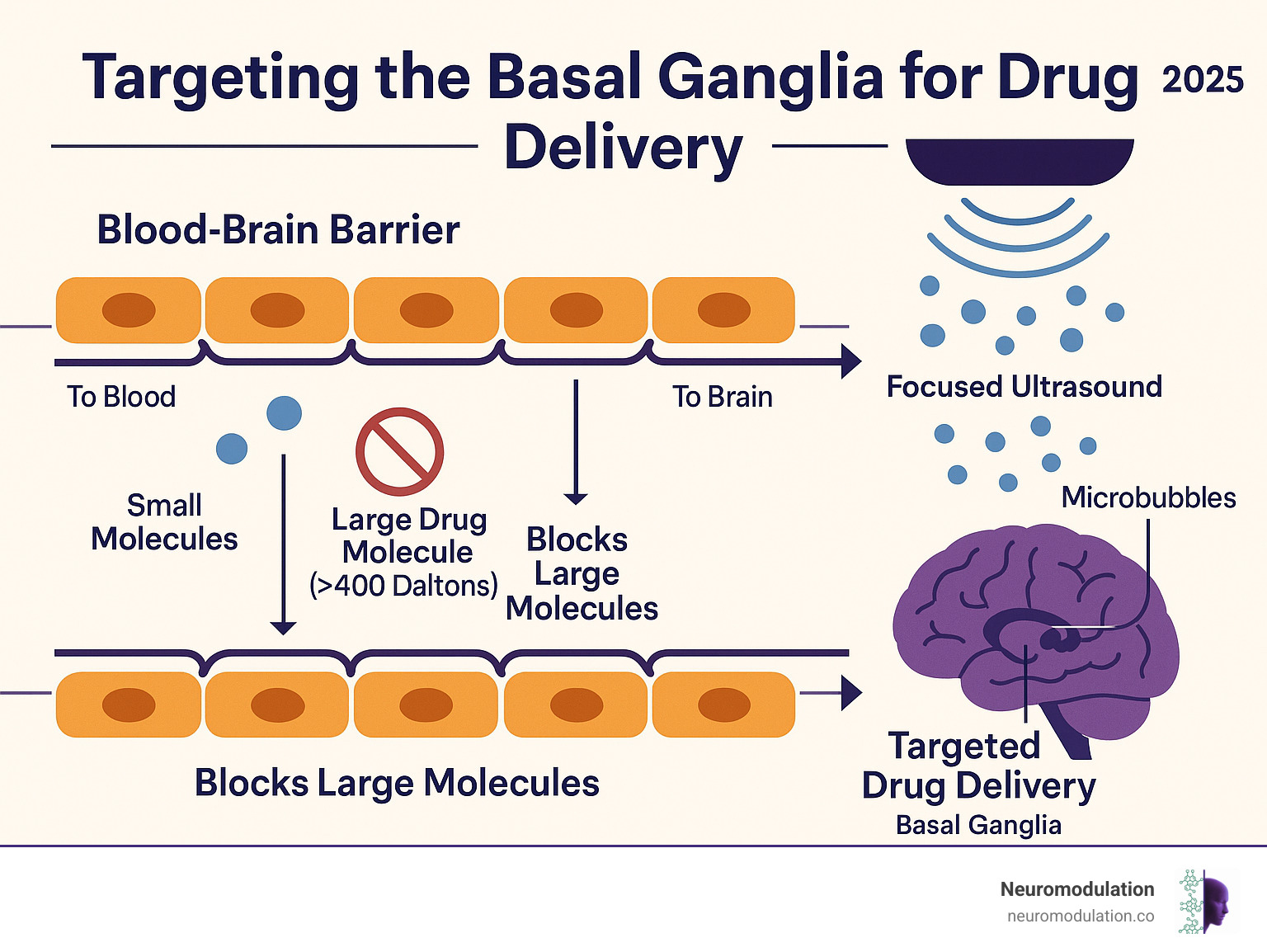 Comprehensive infographic showing the blood-brain barrier structure with tight junctions between endothelial cells, illustrating how it blocks large drug molecules (>400 Daltons) while allowing small molecules to pass, and demonstrating how focused ultrasound combined with microbubbles temporarily opens these tight junctions to enable targeted drug delivery to the basal ganglia - can the basal ganglia be specifically targeted for drug delivery infographic 