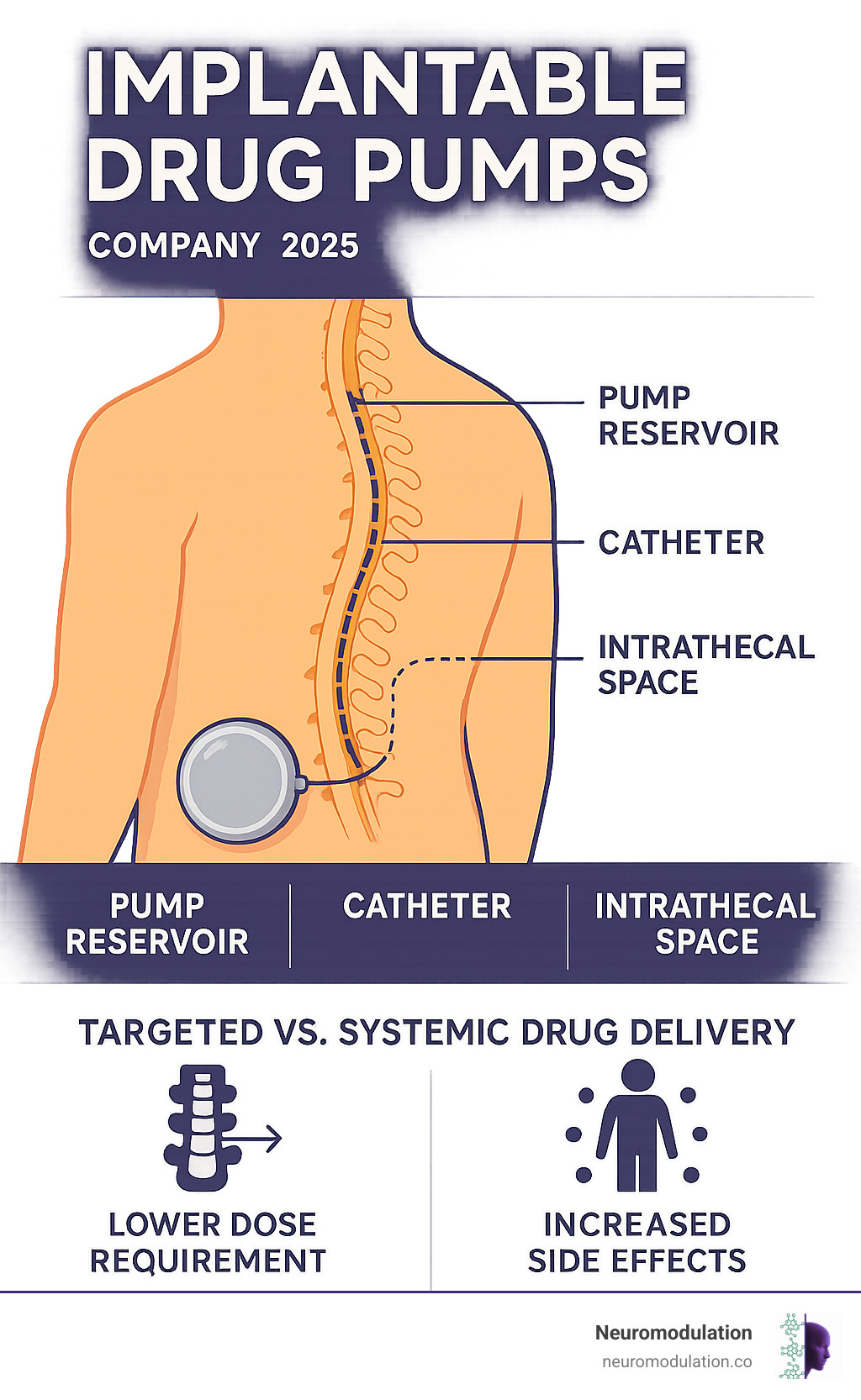 Comprehensive infographic showing implantable drug pump system components including the pump reservoir placed in the abdomen, catheter threading through tissue to the intrathecal space around the spinal cord, medication flow pathway, and comparison of targeted vs systemic drug delivery with dosage requirements and side effect profiles - Implantable drug pumps infographic 