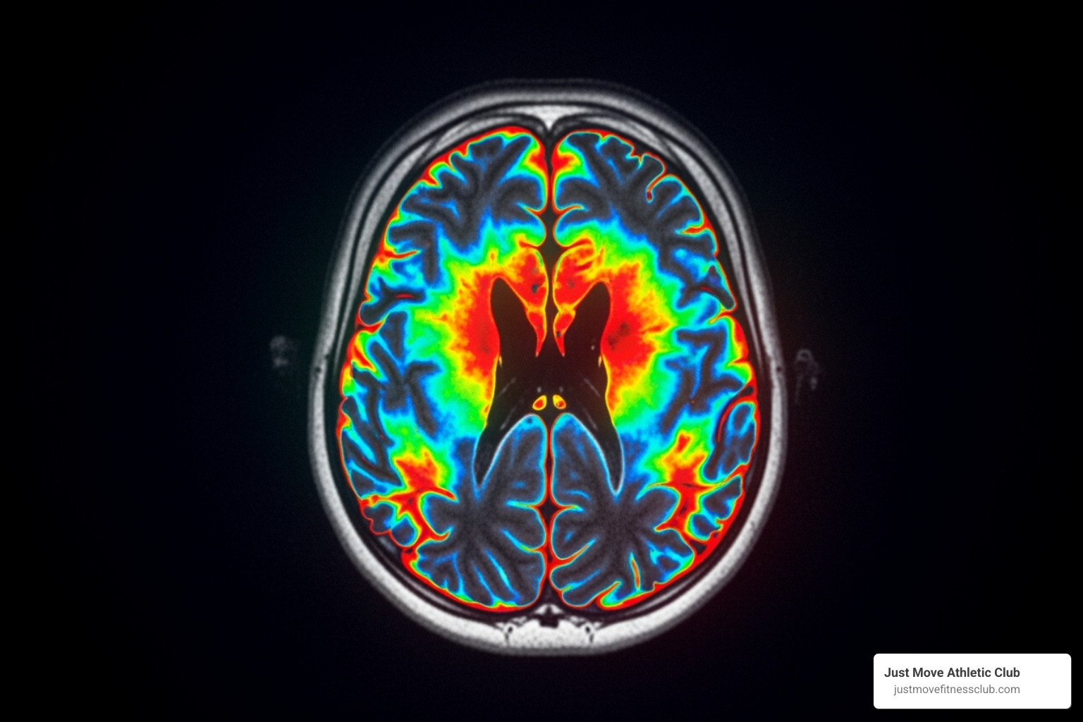 A brain scan showing activity during exercise - holistic fitness approach A brain scan showing activity during exercise - holistic fitness approach