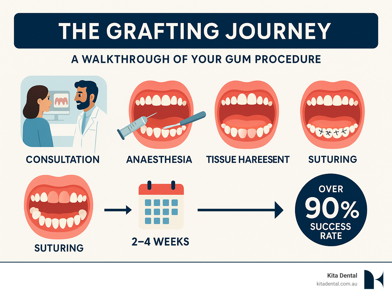 Step-by-step gingival graft procedure infographic showing patient consultation, anaesthesia administration, tissue harvesting from palate, graft placement over receded gums, suturing, and healing timeline with success rate statistics - gingival graft procedure infographic Step-by-step gingival graft procedure infographic showing patient consultation, anaesthesia administration, tissue harvesting from palate, graft placement over receded gums, suturing, and healing timeline with success rate statistics - gingival graft procedure infographic