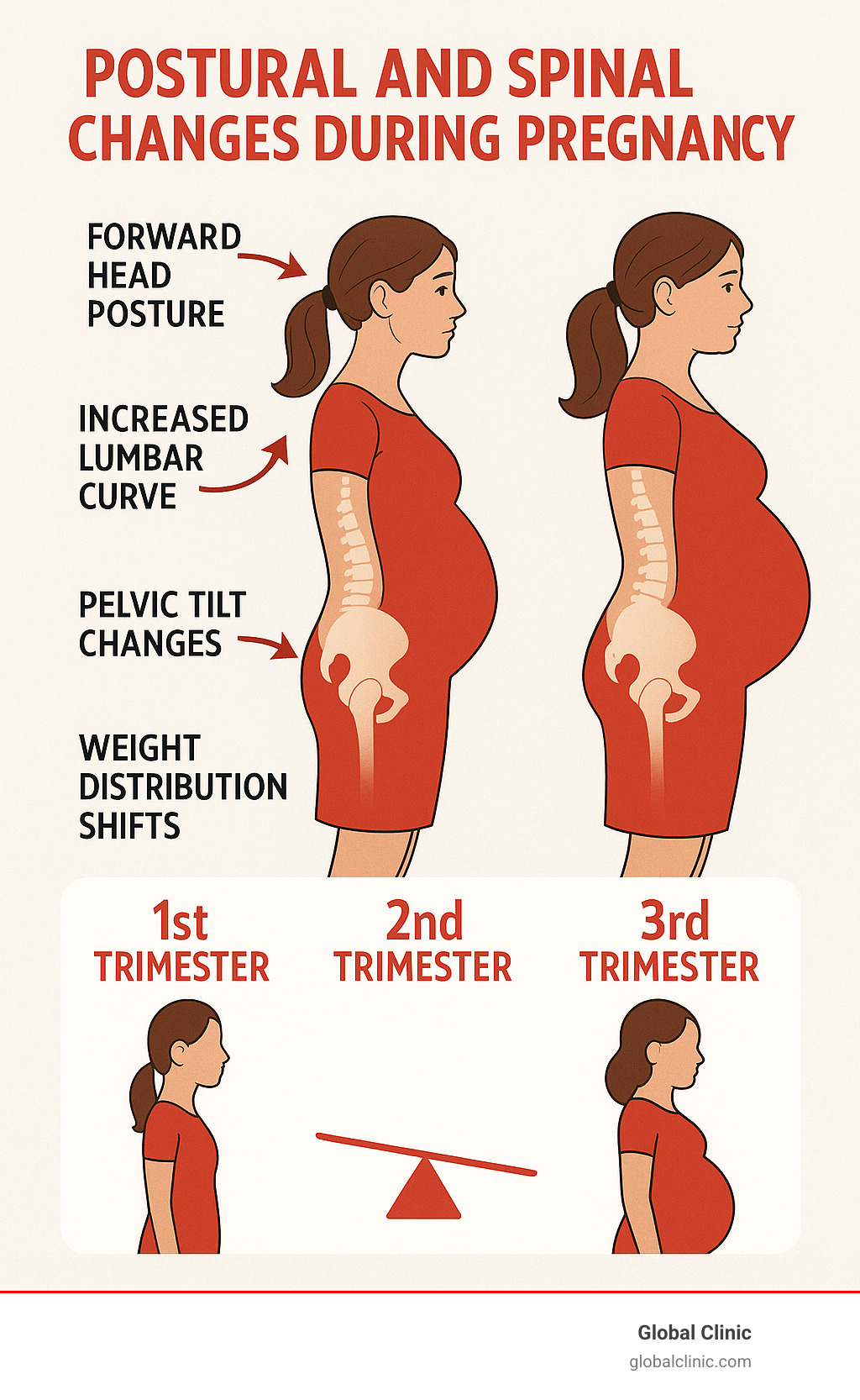 Detailed infographic showing the postural and spinal changes during pregnancy, including forward head posture, increased lumbar curve, pelvic tilt changes, and weight distribution shifts across the three trimesters - prenatal chiropractor near me infographic 