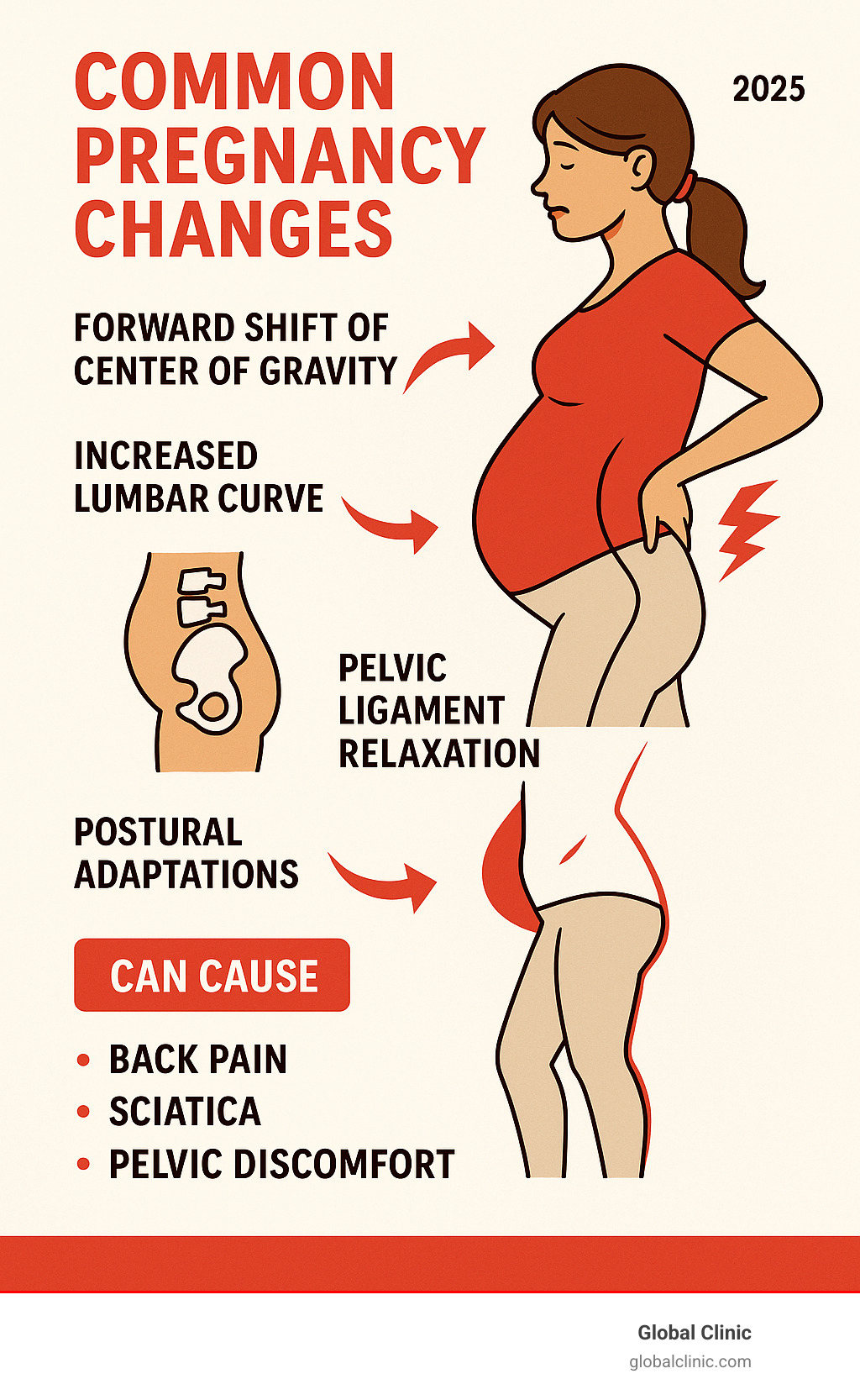 Infographic showing common pregnancy changes: forward center of gravity shift, increased lumbar curve, pelvic ligament relaxation, and postural adaptations that can cause back pain, sciatica, and pelvic discomfort - prenatal chiropractic care infographic 