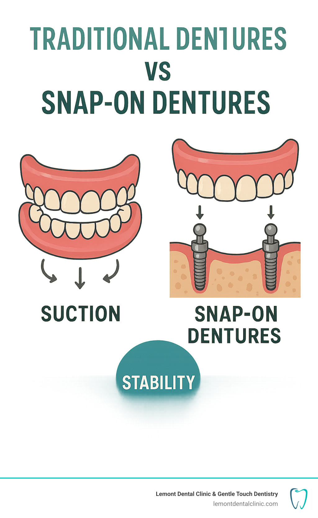 Comparison infographic showing traditional dentures held by suction versus snap-on dentures securely attached to dental implants in the jawbone, highlighting the stability difference - snap on dentures infographic Comparison infographic showing traditional dentures held by suction versus snap-on dentures securely attached to dental implants in the jawbone, highlighting the stability difference - snap on dentures infographic
