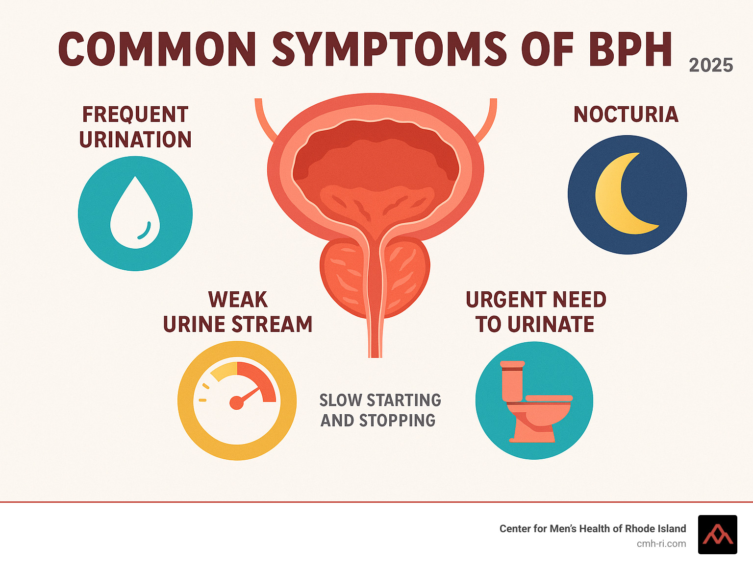 Infographic explaining common symptoms of BPH - BPH treatment infographic 