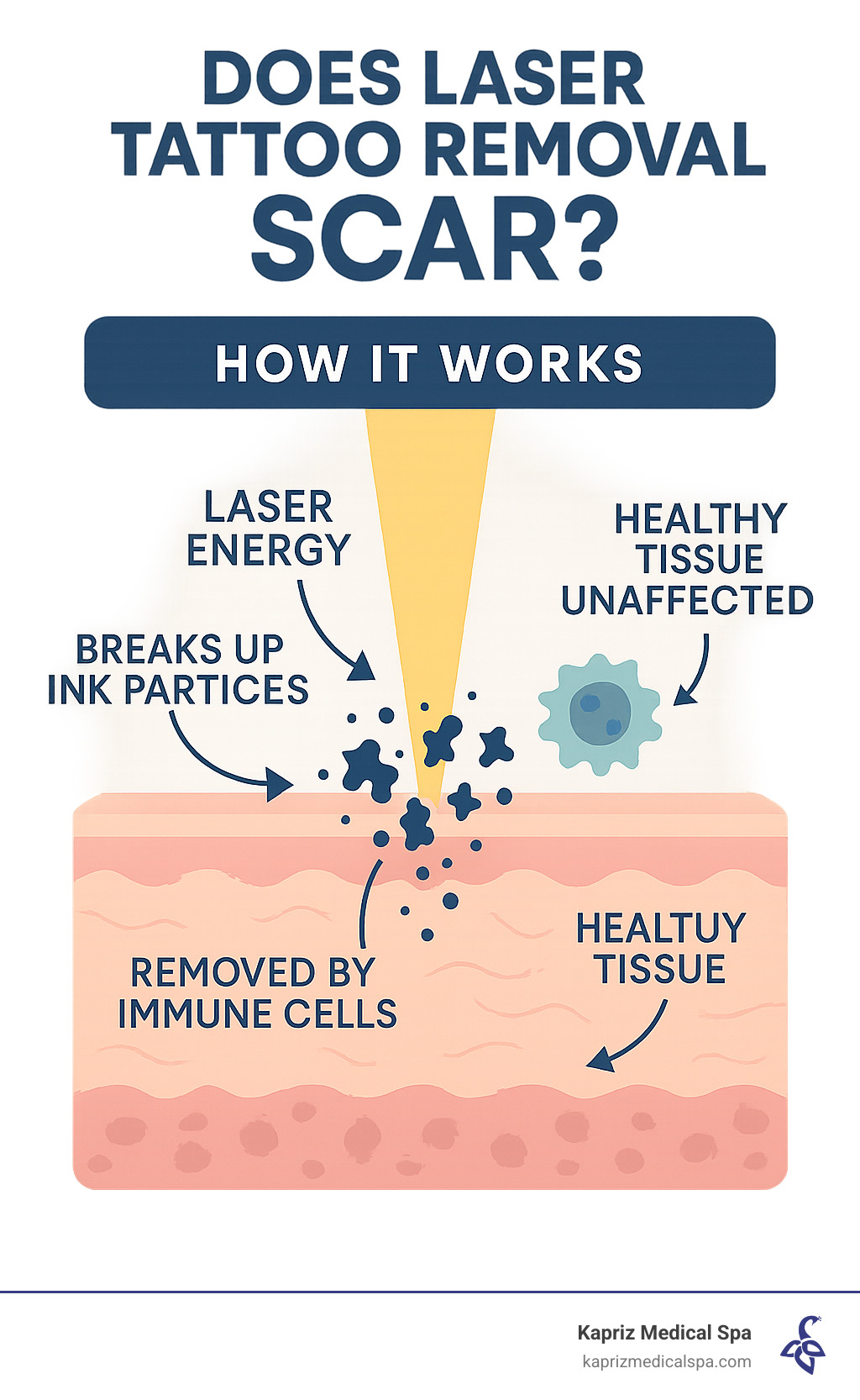 Infographic showing laser energy targeting tattoo ink particles in skin layers, breaking them into smaller fragments that immune cells can remove, while surrounding healthy tissue remains unaffected - does laser tattoo removal scar infographic Infographic showing laser energy targeting tattoo ink particles in skin layers, breaking them into smaller fragments that immune cells can remove, while surrounding healthy tissue remains unaffected - does laser tattoo removal scar infographic