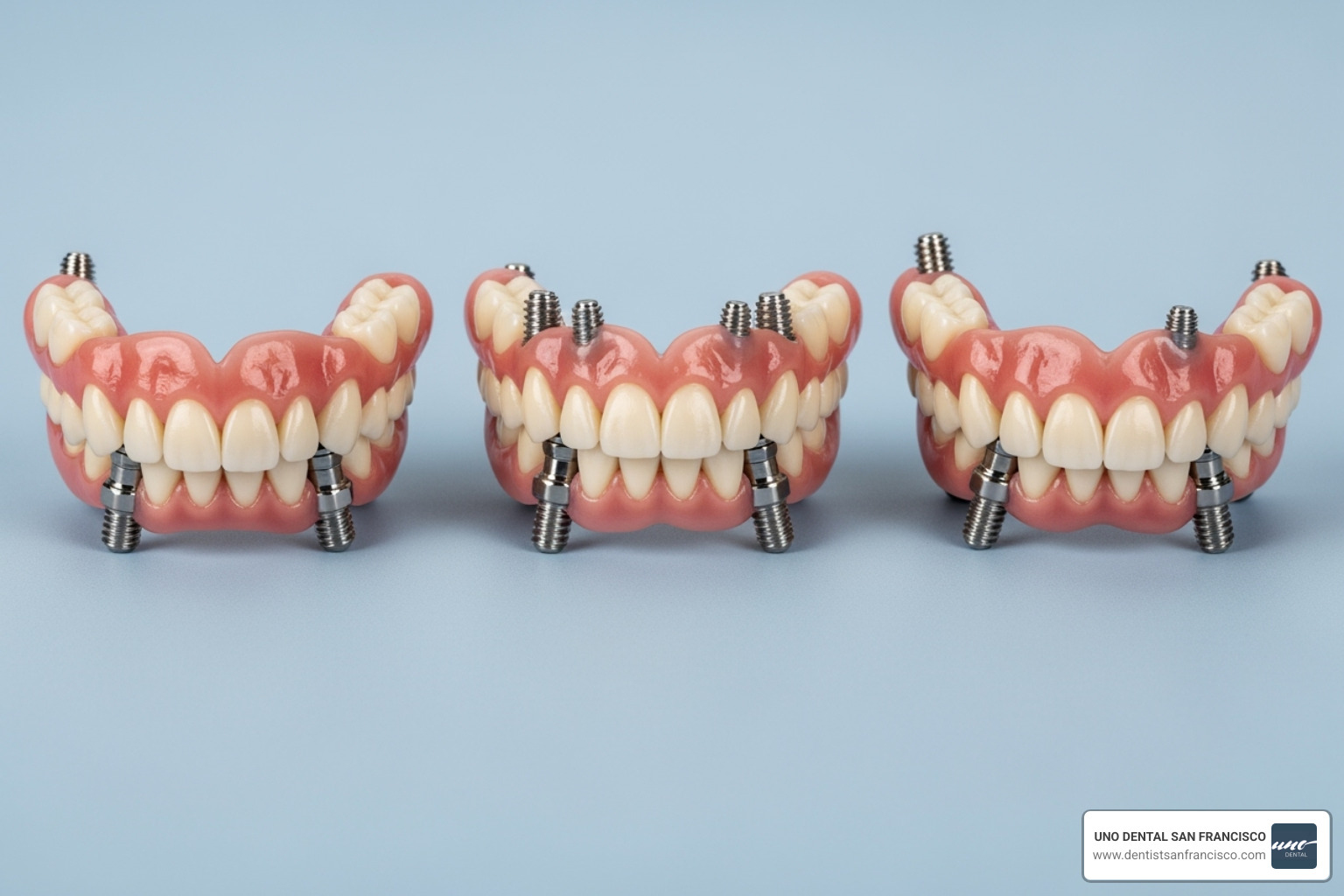 cost breakdown chart for implant dentures showing ranges for different types of implant supported dentures - Implant supported dentures cost