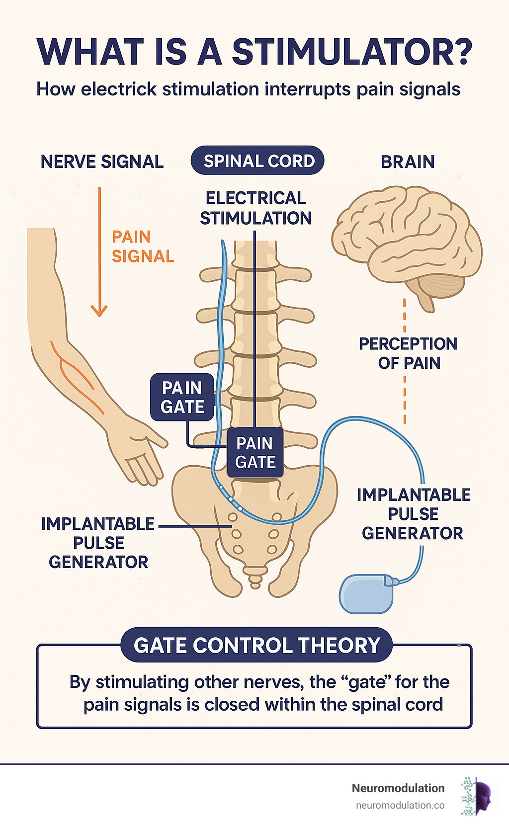 Comprehensive infographic showing the complete neuromodulation pathway from nerve signal generation through spinal cord processing to brain perception, with detailed illustrations of how electrical stimulation interrupts pain signals, including anatomical cross-sections of the spinal cord, electrode placement, and the gate control theory mechanism - what is a stimulator infographic 