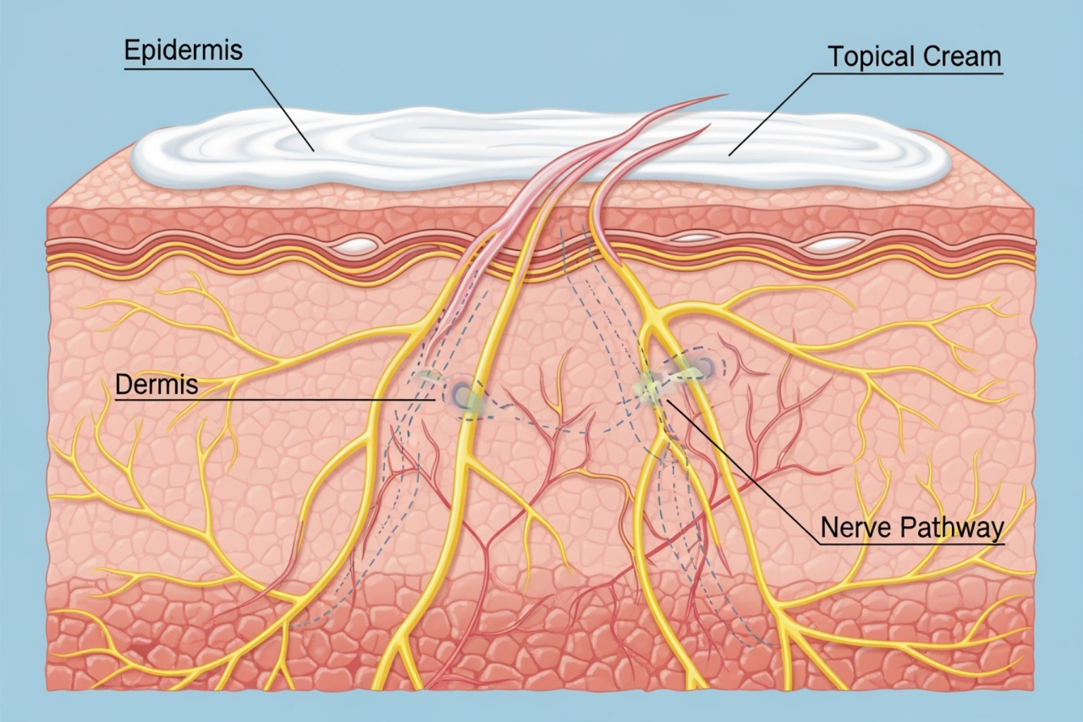 diagram showing how topical creams block pain signals - cream for pulled muscles