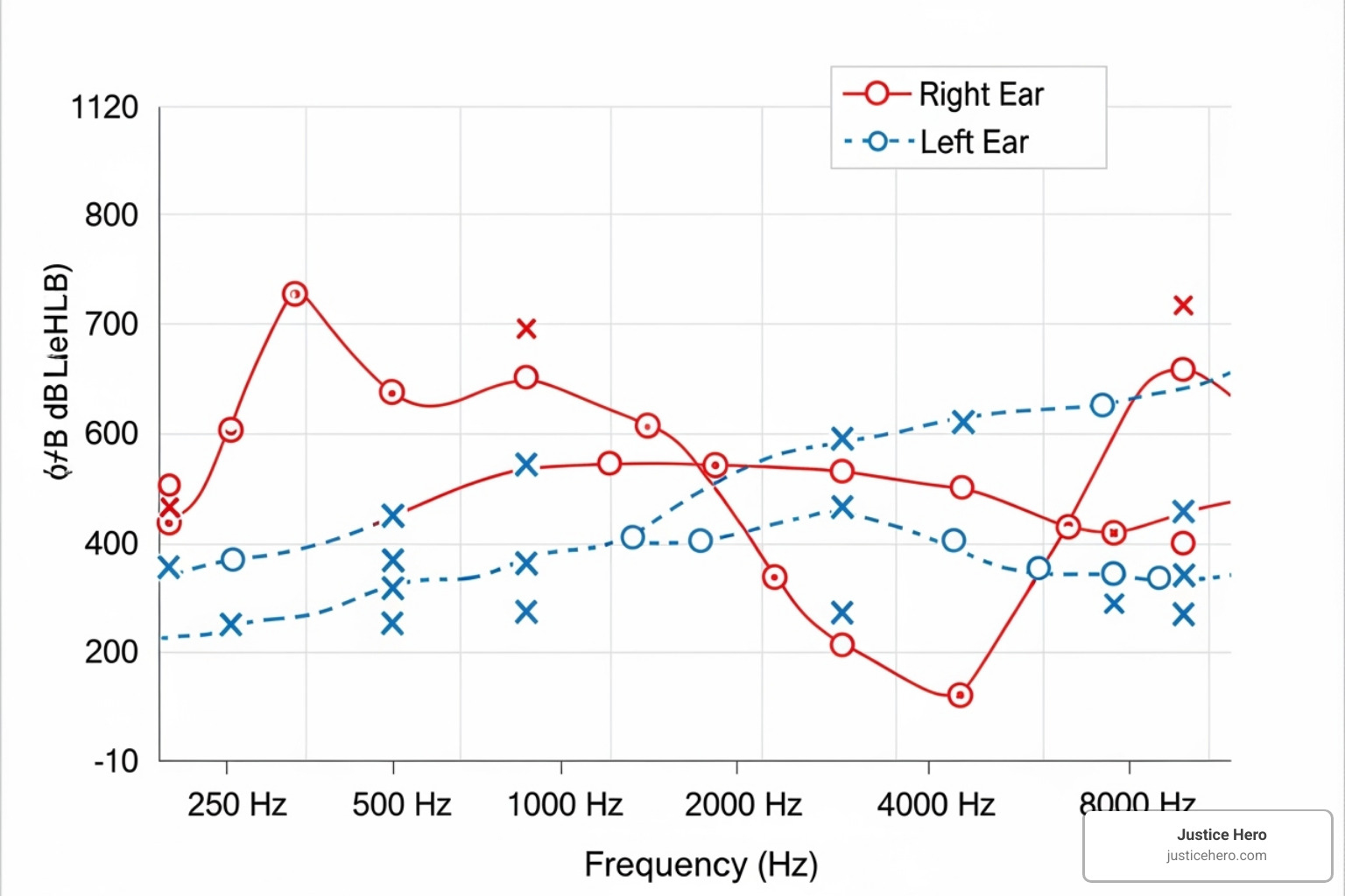 Audiogram report showing various frequencies and decibel levels of hearing - earplug lawsuit compensation amounts