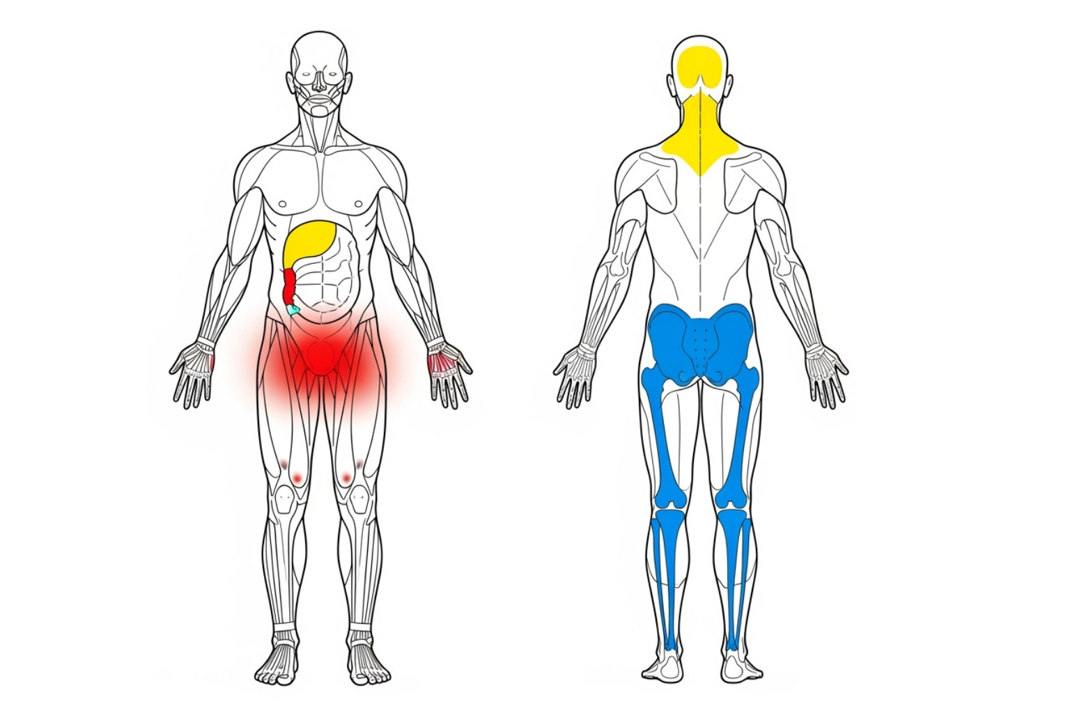 Illustration of the Widespread Pain Index (WPI) body map - Fibromyalgia
