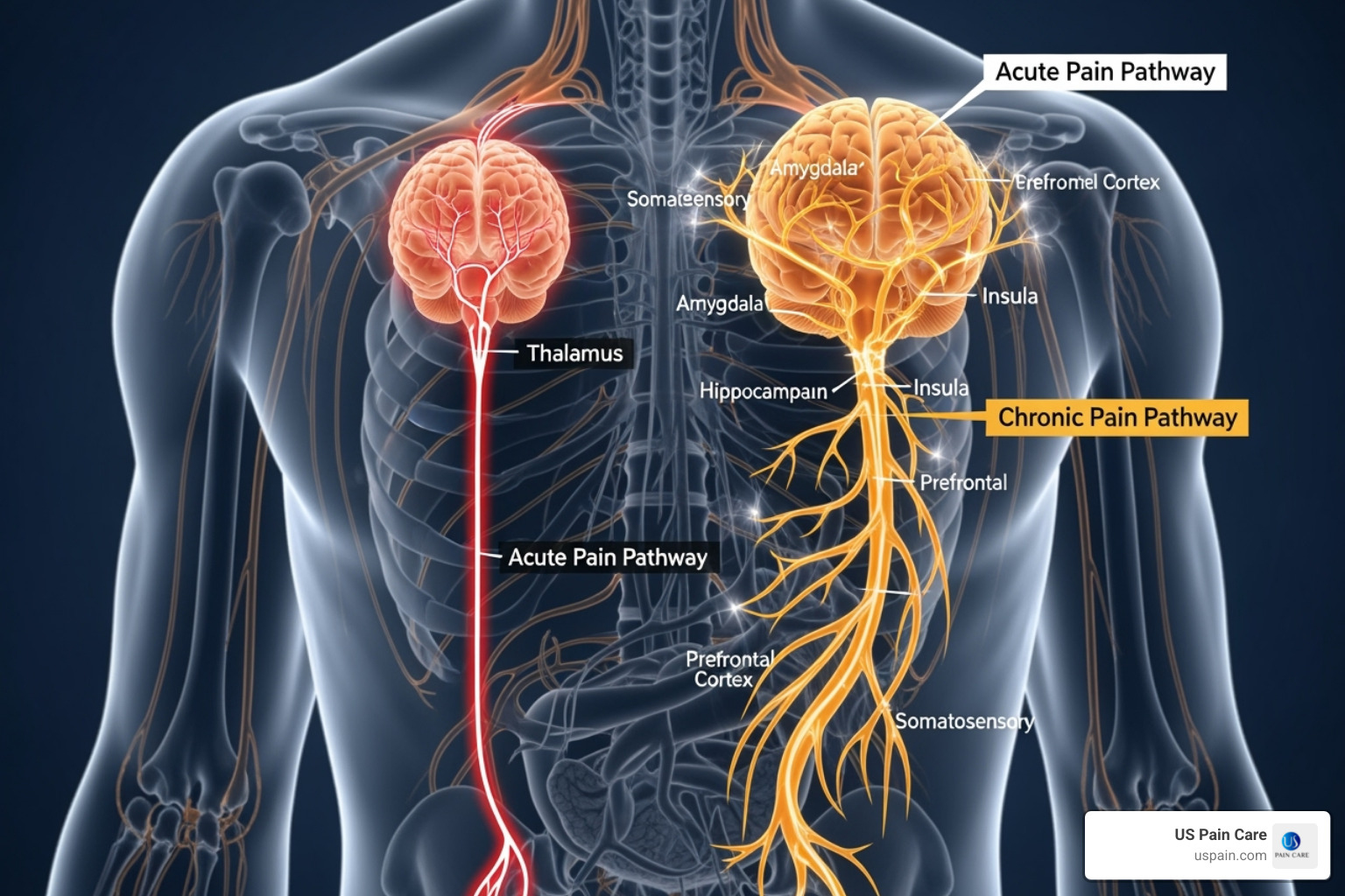Diagram illustrating the difference between acute and chronic pain pathways in the nervous system - pain management psychotherapy