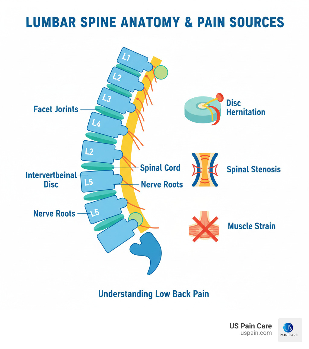 infographic showing the lumbar spine anatomy with labeled vertebrae L1-L5, intervertebral discs, spinal cord, nerve roots, facet joints, and common pain sources including disc herniation, spinal stenosis, and muscle strain - what are possible medical treatments for low back pain infographic 
