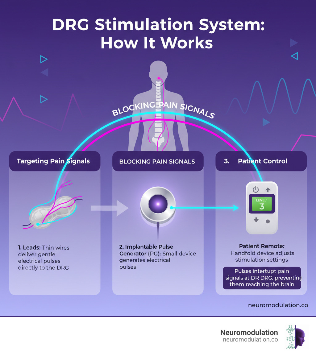 infographic illustrating how a DRG stimulator system works, from the leads on the ganglion to the generator and patient remote - DRG for chronic pain infographic 