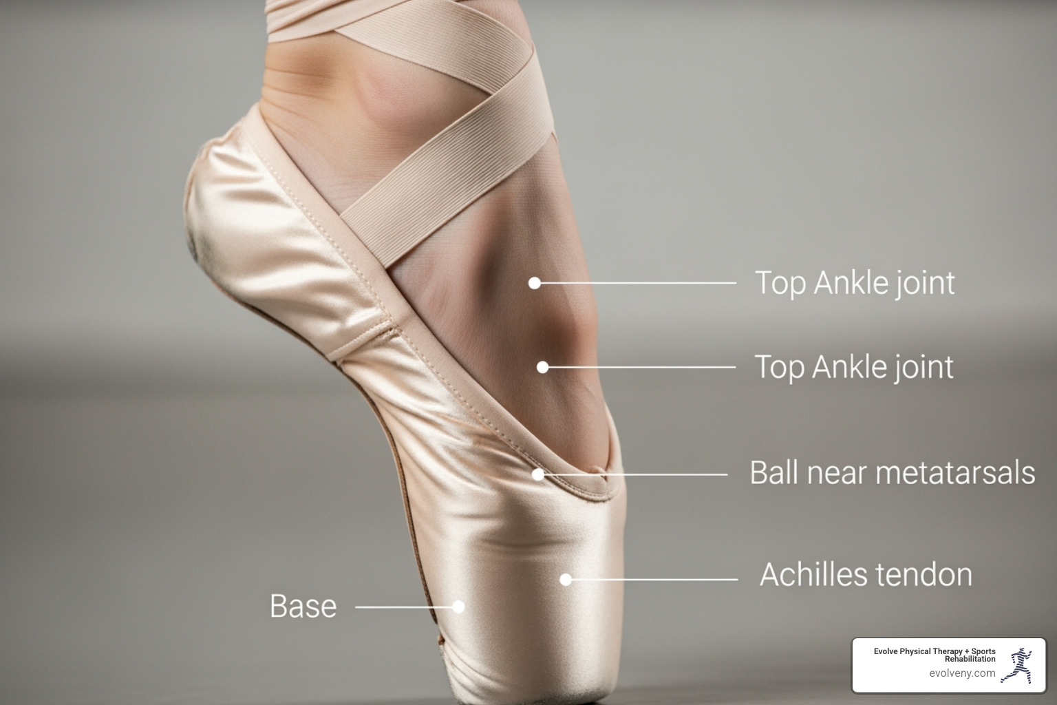 dancer en pointe, with arrows indicating pressure points on the foot and ankle - Physical therapy for dancers dancer en pointe, with arrows indicating pressure points on the foot and ankle - Physical therapy for dancers