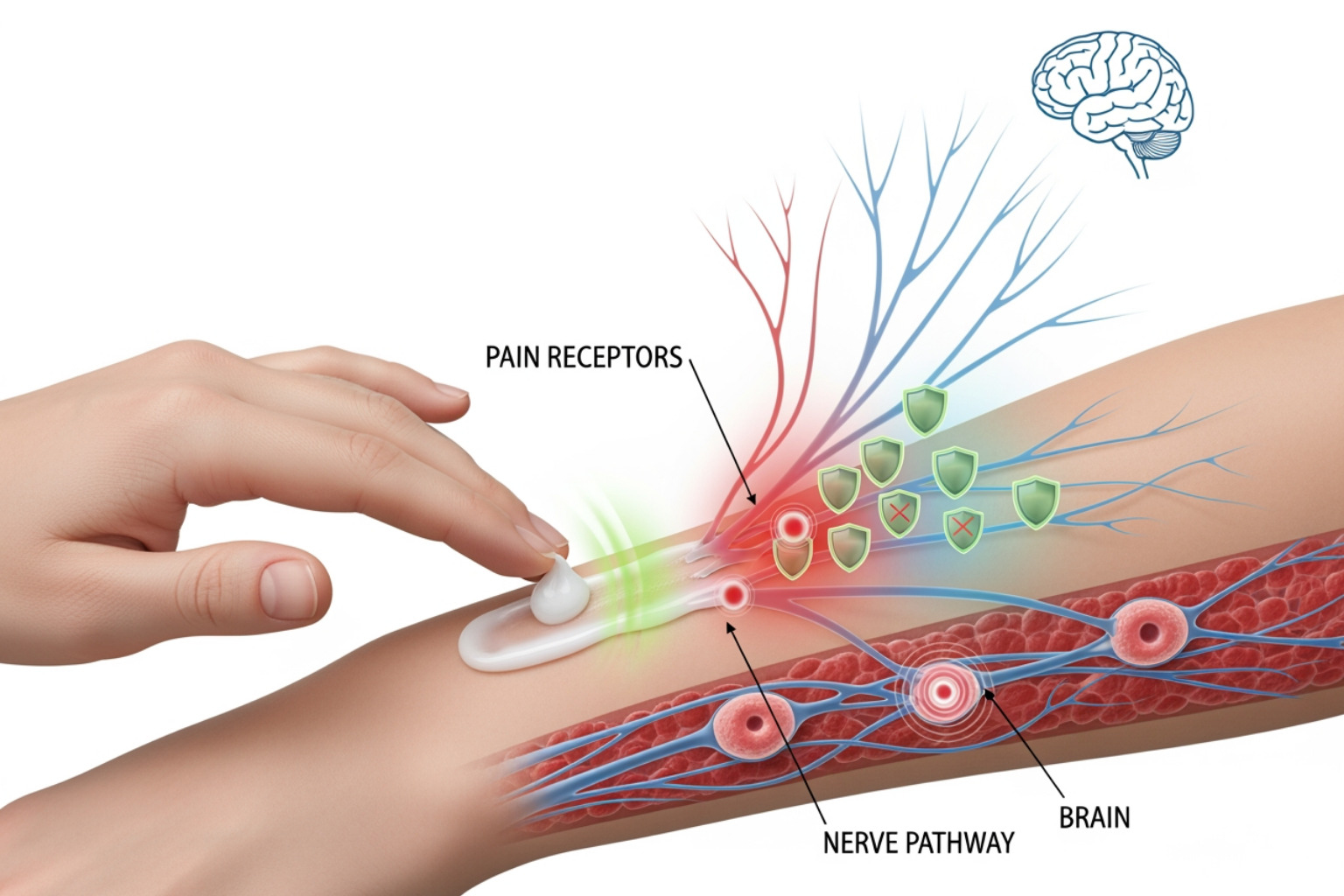 Diagram showing pain receptors sending signals to the brain, and topical cream being applied to the skin, with arrows indicating how the cream's active ingredients interfere with and block these pain signals before they reach the brain - muscle pull cream