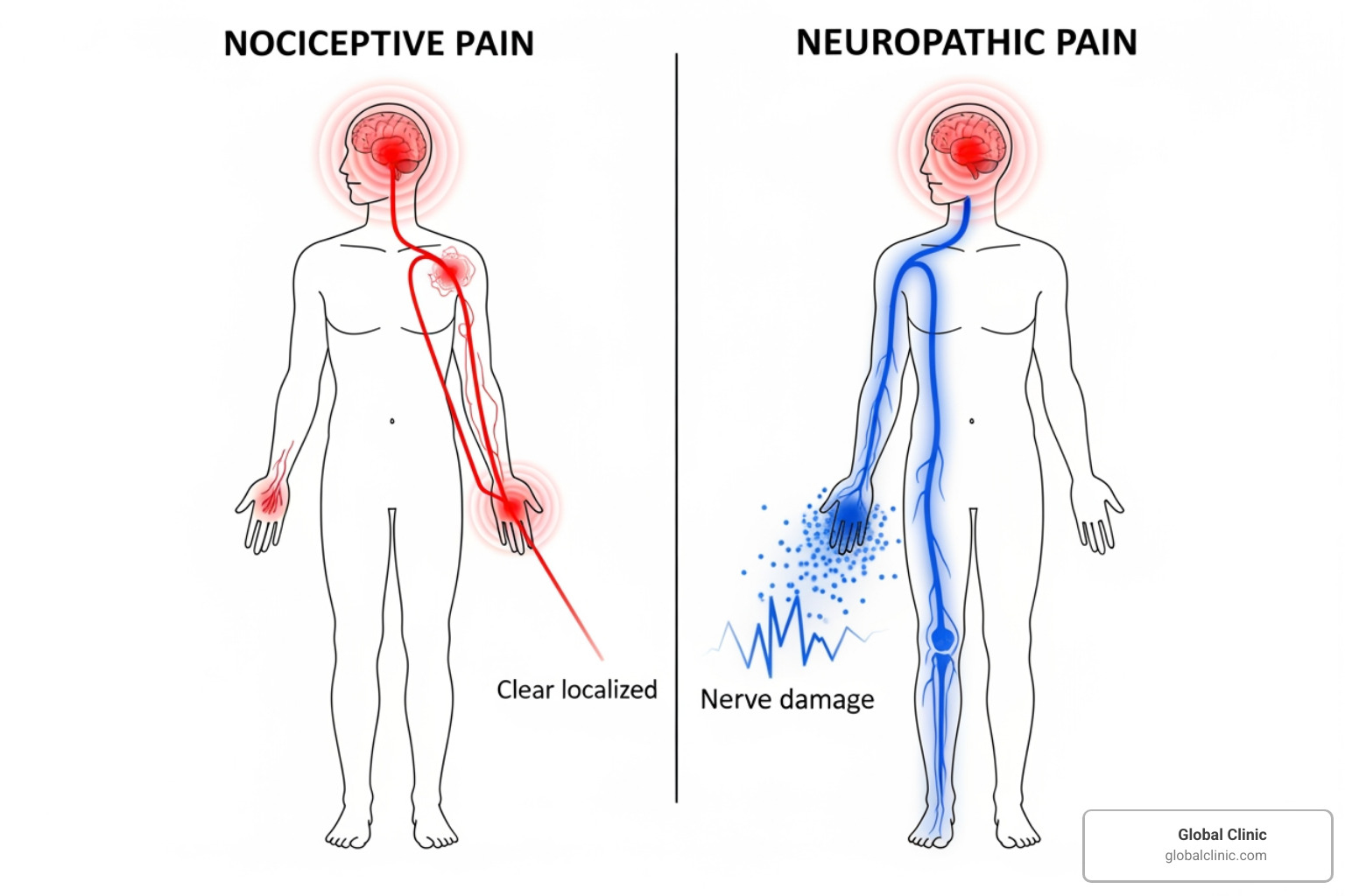 illustrating the difference between nociceptive and neuropathic pain signals - Effective pain management illustrating the difference between nociceptive and neuropathic pain signals - Effective pain management