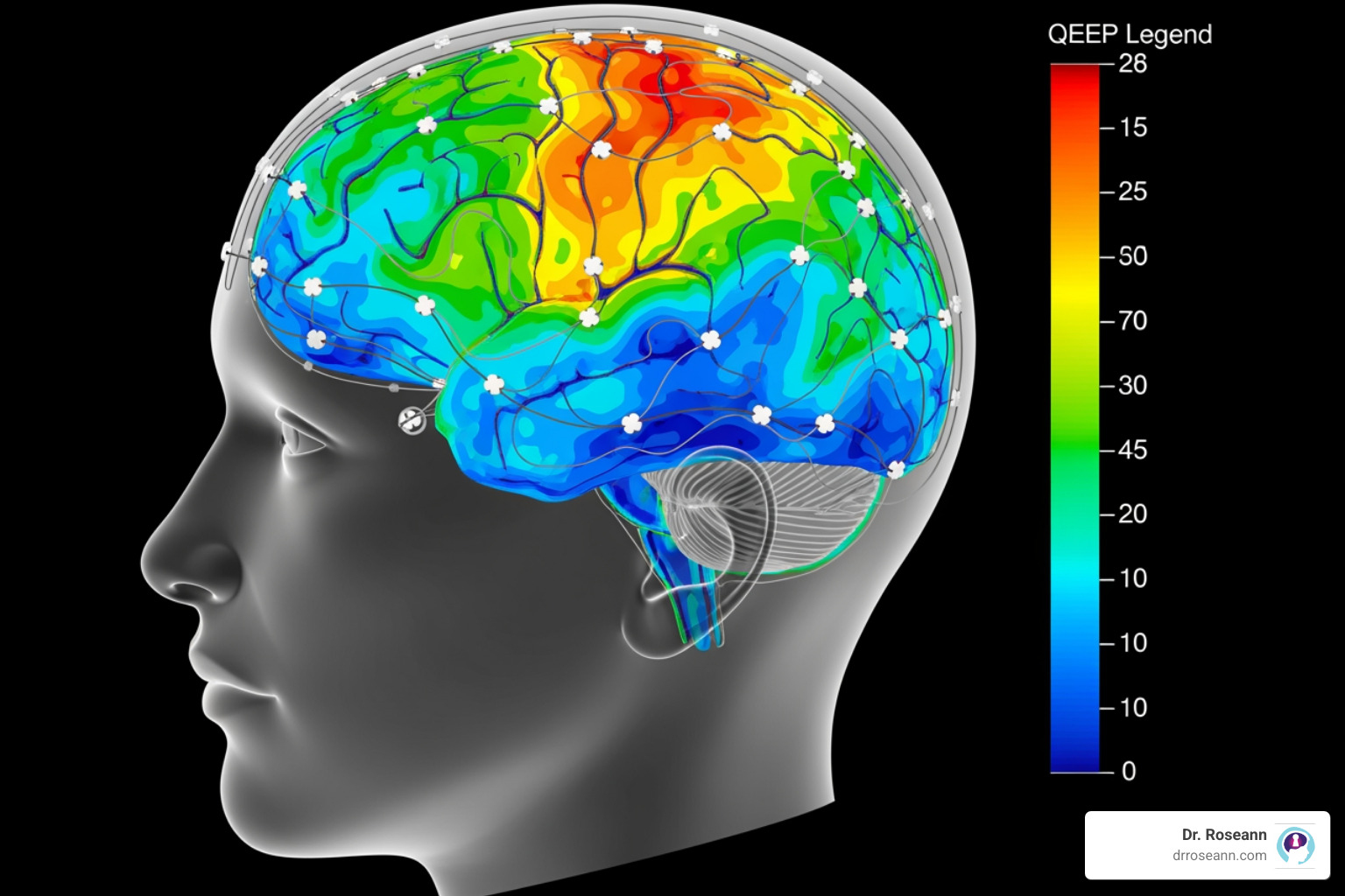 QEEG brain map - does neurofeedback therapy have side effects