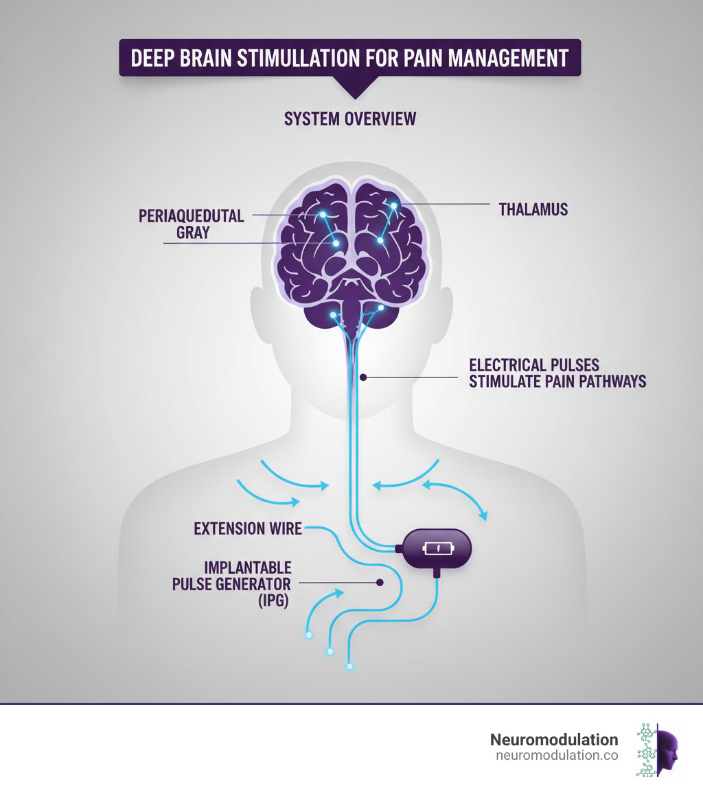 Infographic showing the complete deep brain stimulation system for pain management: brain cross-section with electrode placement in pain-related target areas (such as periaqueductal gray or thalamus), connected by an extension wire running under the skin down the neck and chest to an implantable pulse generator (battery pack) positioned near the collarbone, with labels indicating each component and showing how electrical pulses travel from the generator through the wire to stimulate specific brain regions - deep brain stimulation pain infographic Infographic showing the complete deep brain stimulation system for pain management: brain cross-section with electrode placement in pain-related target areas (such as periaqueductal gray or thalamus), connected by an extension wire running under the skin down the neck and chest to an implantable pulse generator (battery pack) positioned near the collarbone, with labels indicating each component and showing how electrical pulses travel from the generator through the wire to stimulate specific brain regions - deep brain stimulation pain infographic