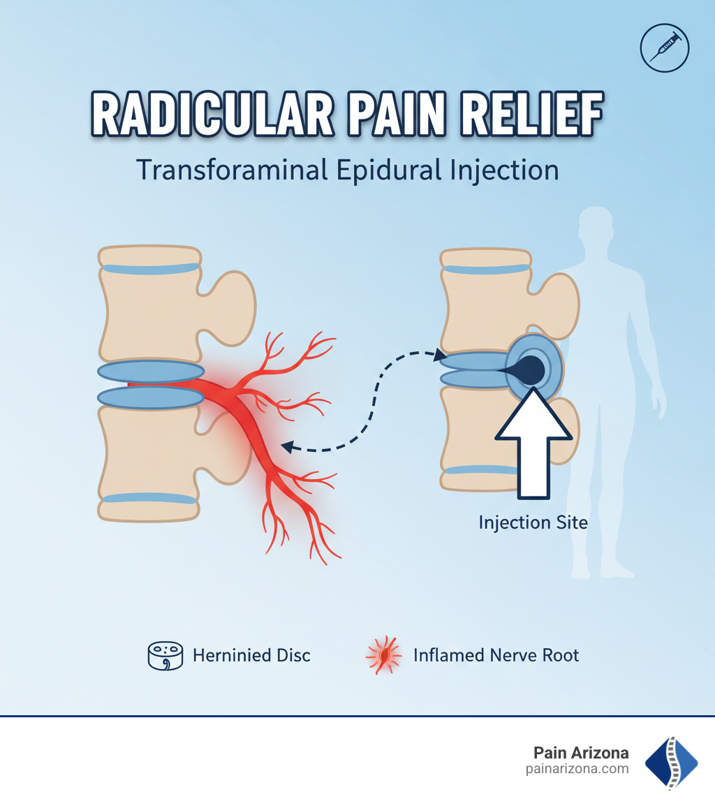 infographic showing a herniated disc compressing a spinal nerve root, causing inflammation and radiating pain down the leg, with an arrow pointing to the neural foramen where the transforaminal epidural injection is delivered to reduce inflammation - transforaminal epidural injection infographic 