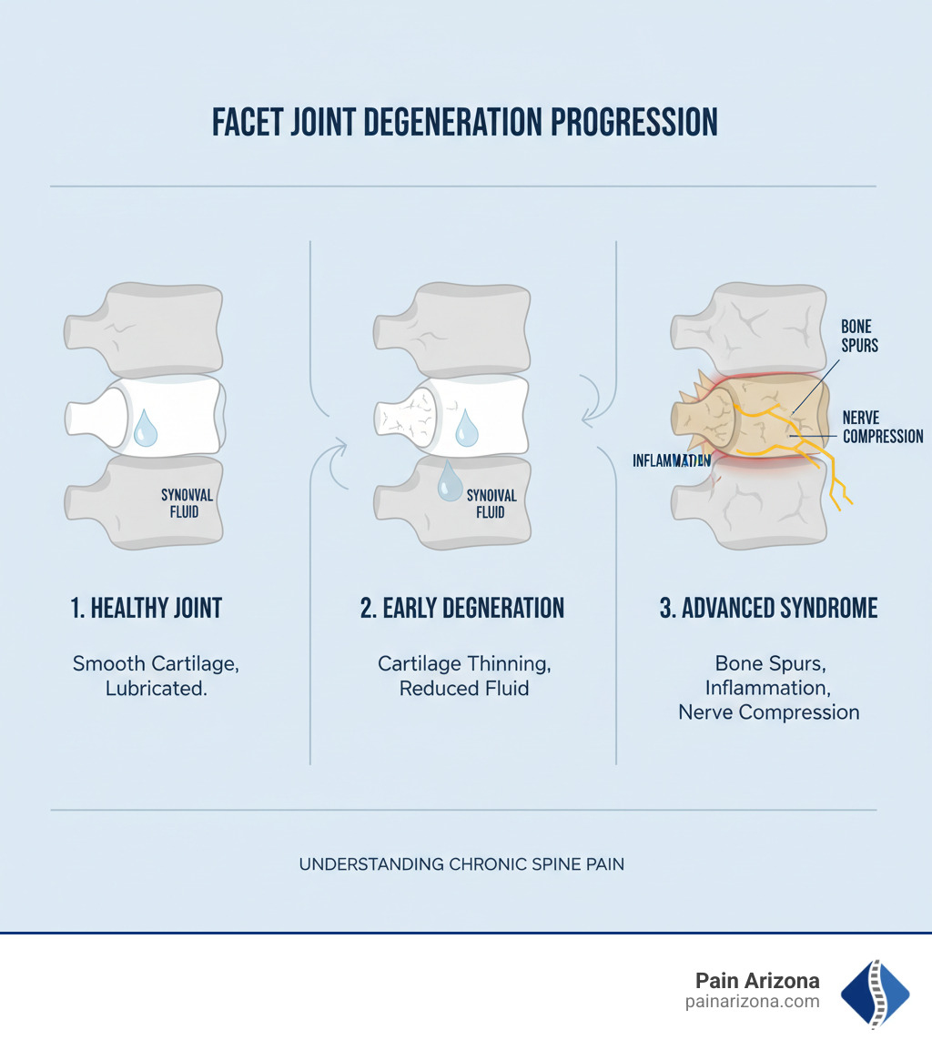 infographic showing the progression from a healthy facet joint with smooth cartilage and synovial fluid to early degeneration with cartilage thinning to advanced facet joint syndrome with bone spurs, inflammation, and nerve compression - facet joint pain treatment infographic 