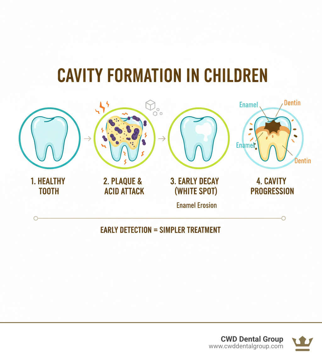 Infographic showing the progression of cavity formation in children's teeth, from healthy tooth with protective enamel layer, to bacteria and plaque buildup feeding on sugars, to acid erosion creating a white spot, to decay progressing through enamel into dentin, with labels for each stage and visual representation of tooth structure - cavity treatment for kids infographic Infographic showing the progression of cavity formation in children's teeth, from healthy tooth with protective enamel layer, to bacteria and plaque buildup feeding on sugars, to acid erosion creating a white spot, to decay progressing through enamel into dentin, with labels for each stage and visual representation of tooth structure - cavity treatment for kids infographic