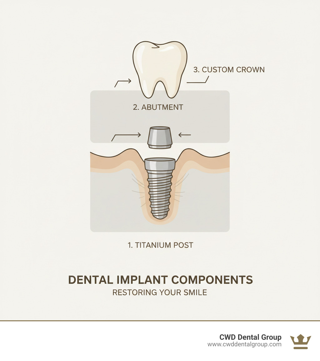 infographic showing dental implant components: titanium post surgically placed in jawbone, abutment connector piece attached to post, and custom crown placed on top to match natural teeth - Implant dentist Tallahassee infographic 