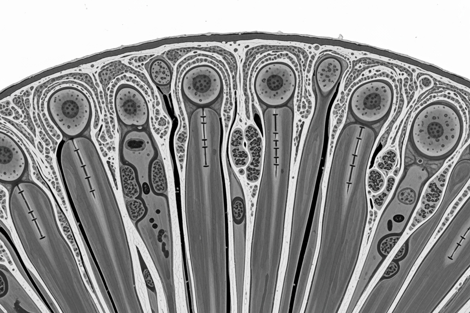 microscopic view of a muscle fiber - sore from working out microscopic view of a muscle fiber - sore from working out