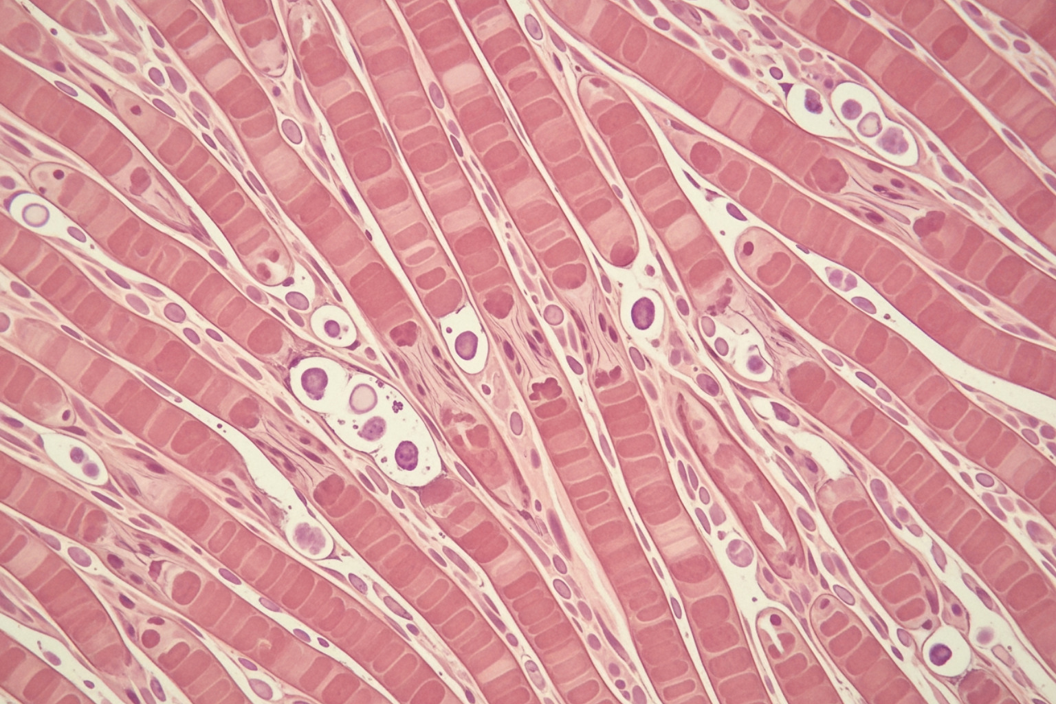 illustrating muscle fibers and the concept of micro-tears - muscle sore after massage illustrating muscle fibers and the concept of micro-tears - muscle sore after massage